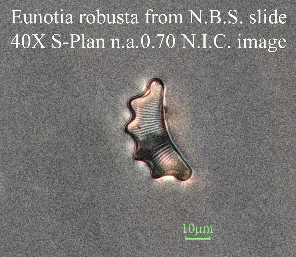 diatom