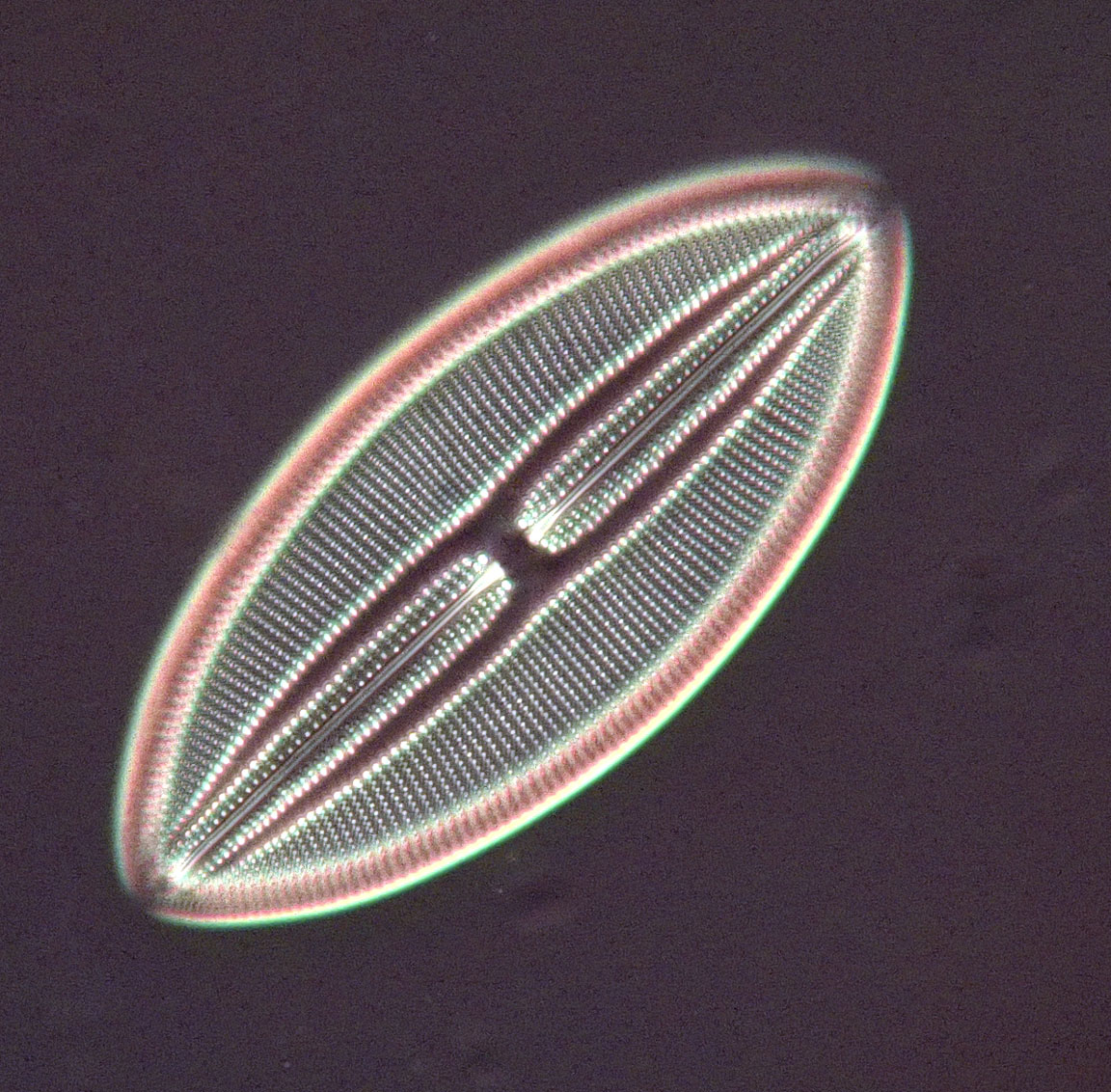 diatom