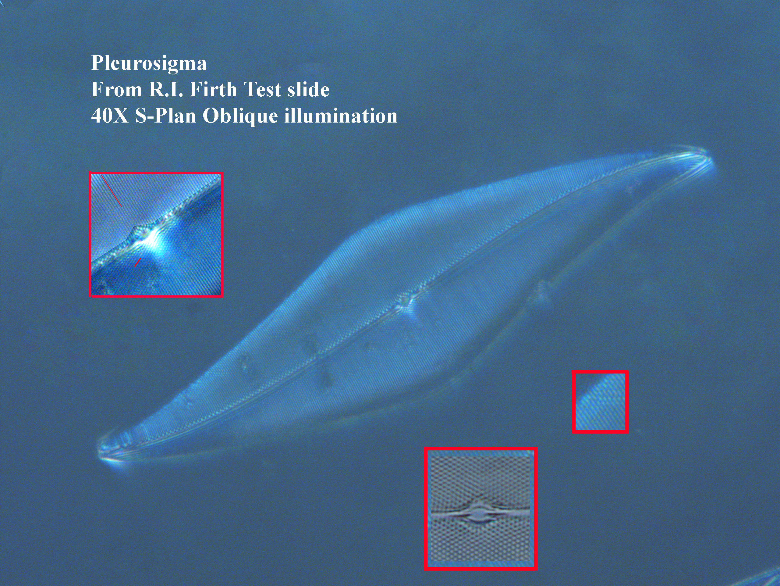 P. angulatum 40X oblique illumination
