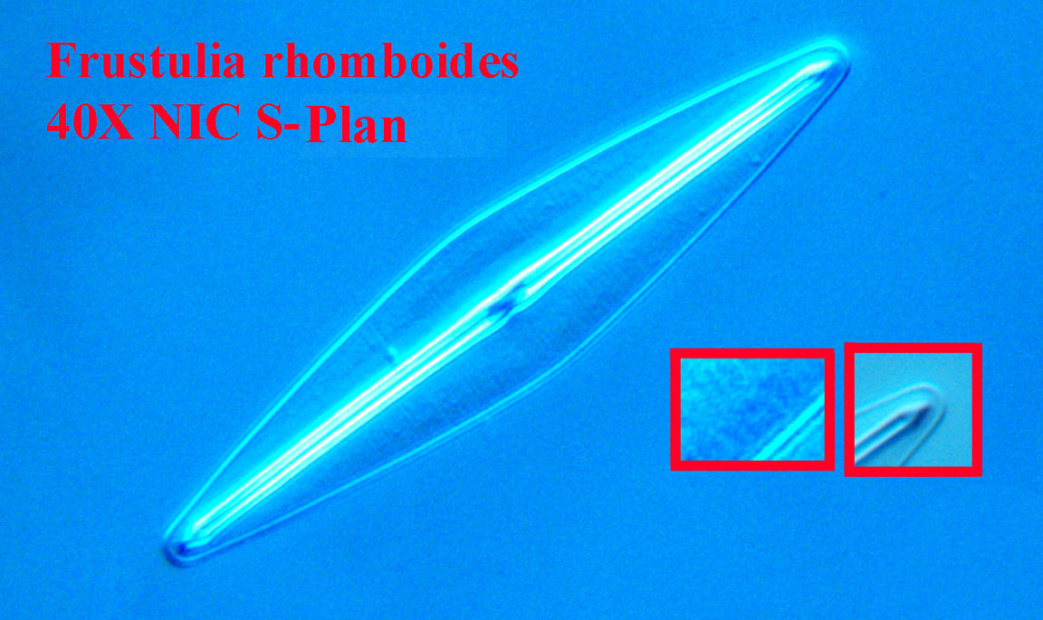 diatom