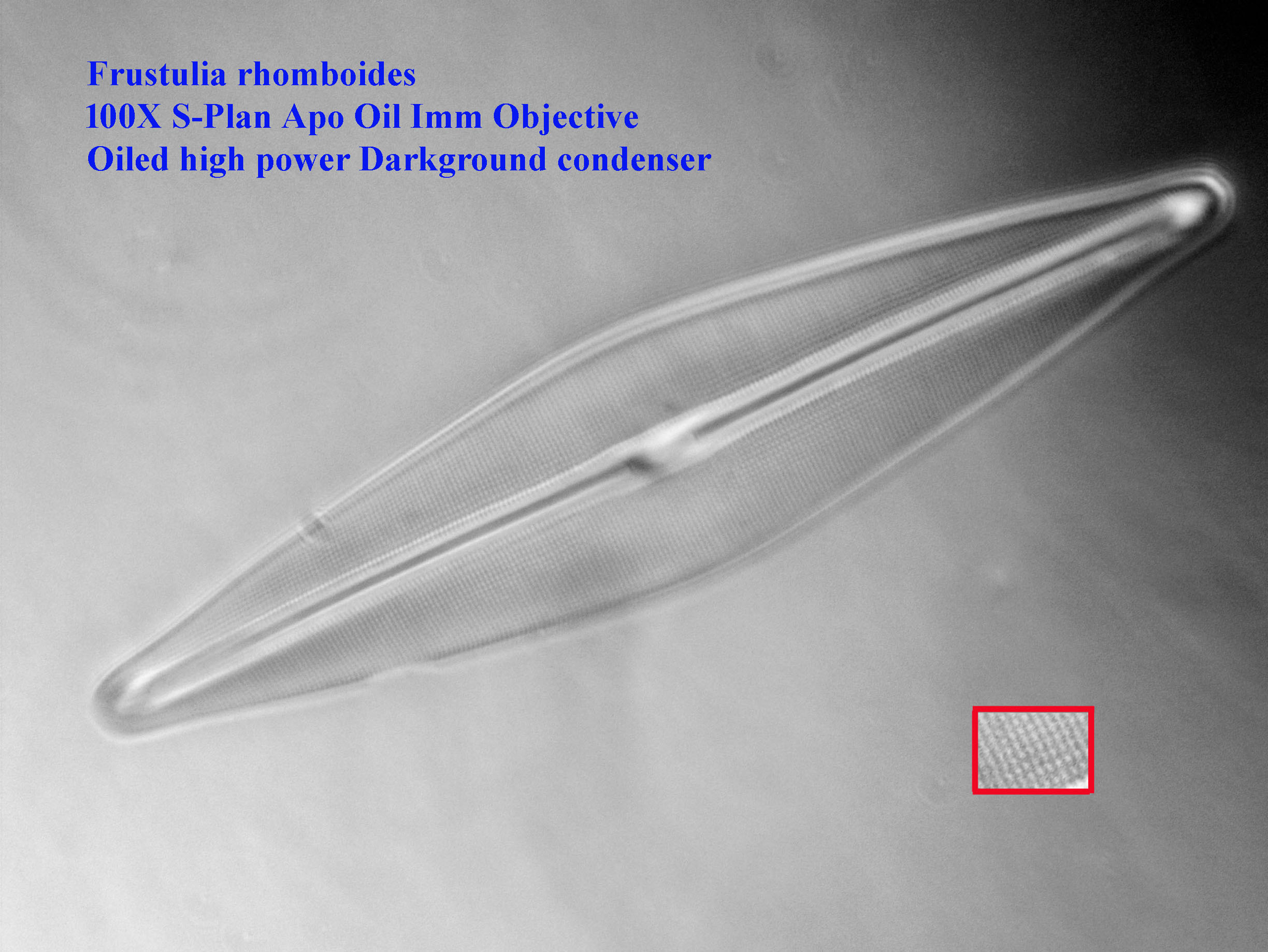diatom
