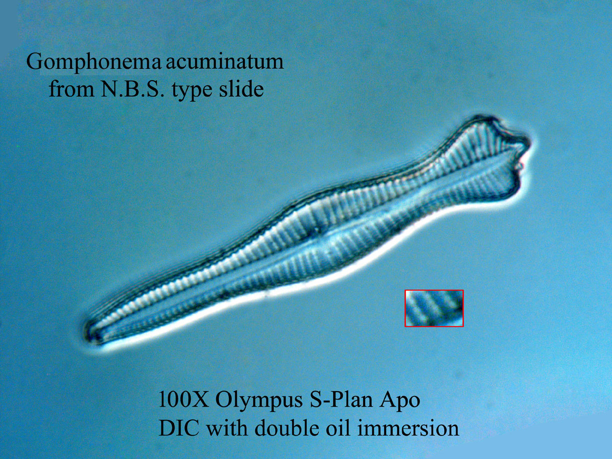 diatom