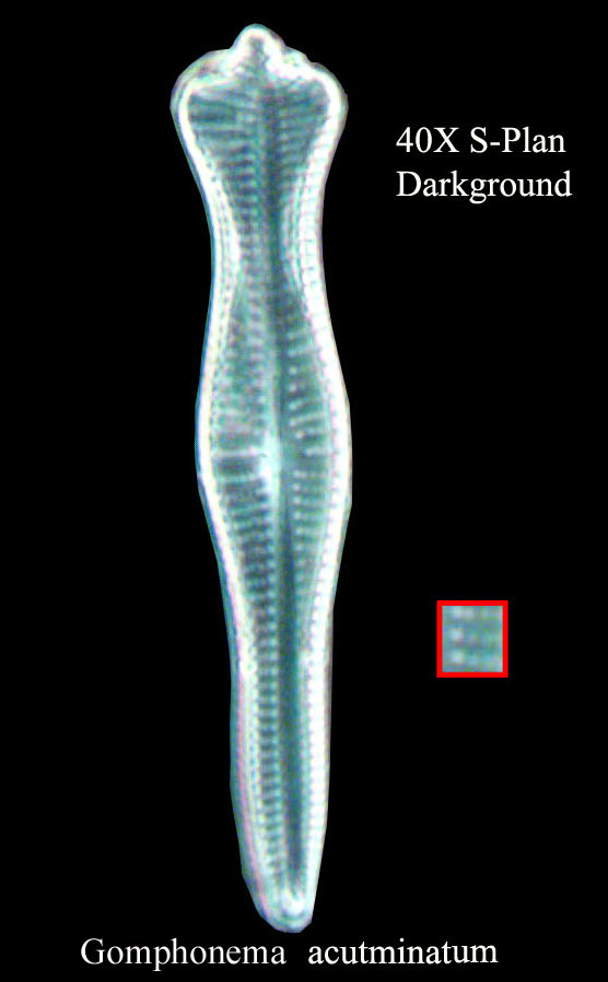 diatom