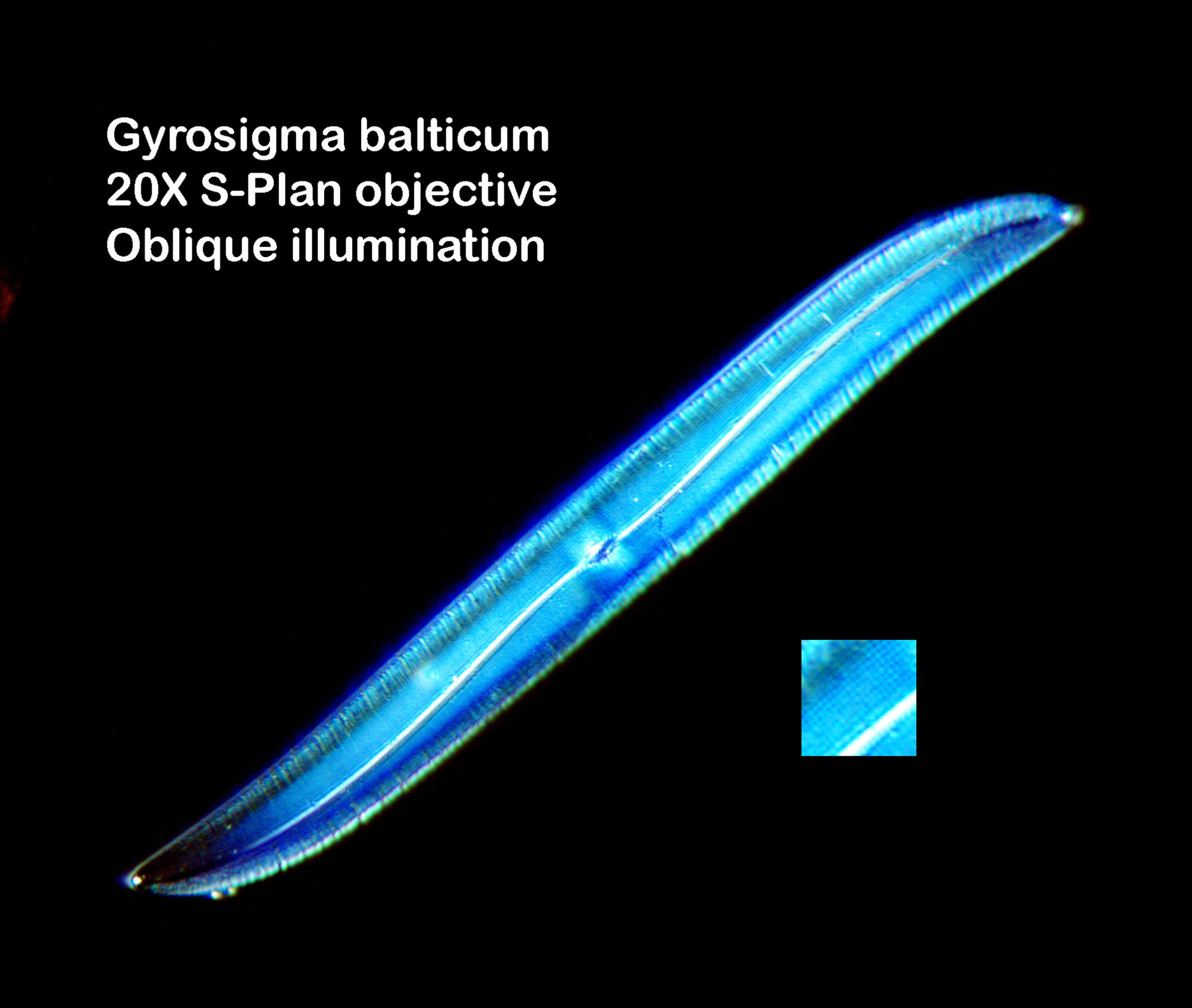 diatom