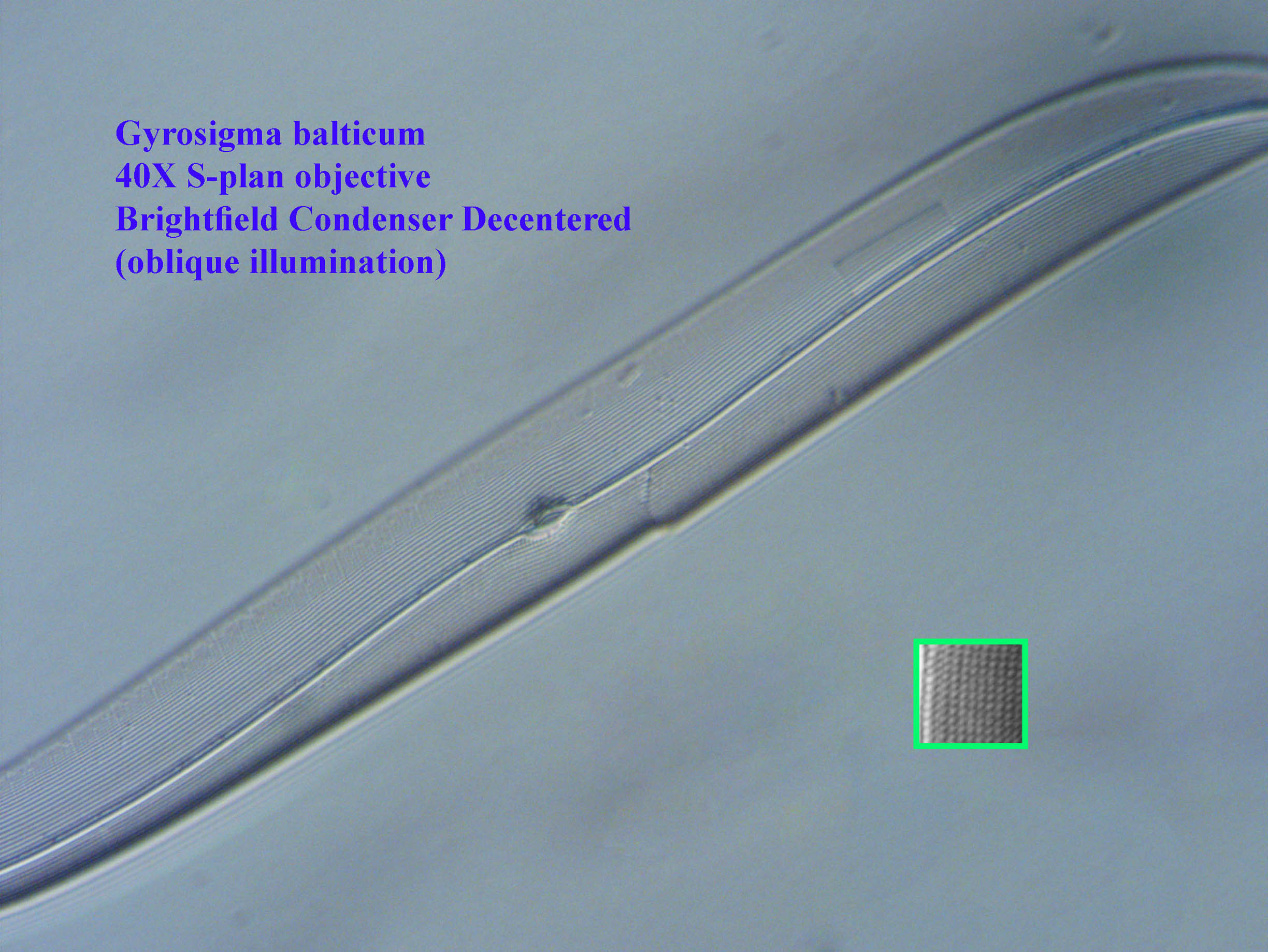diatom