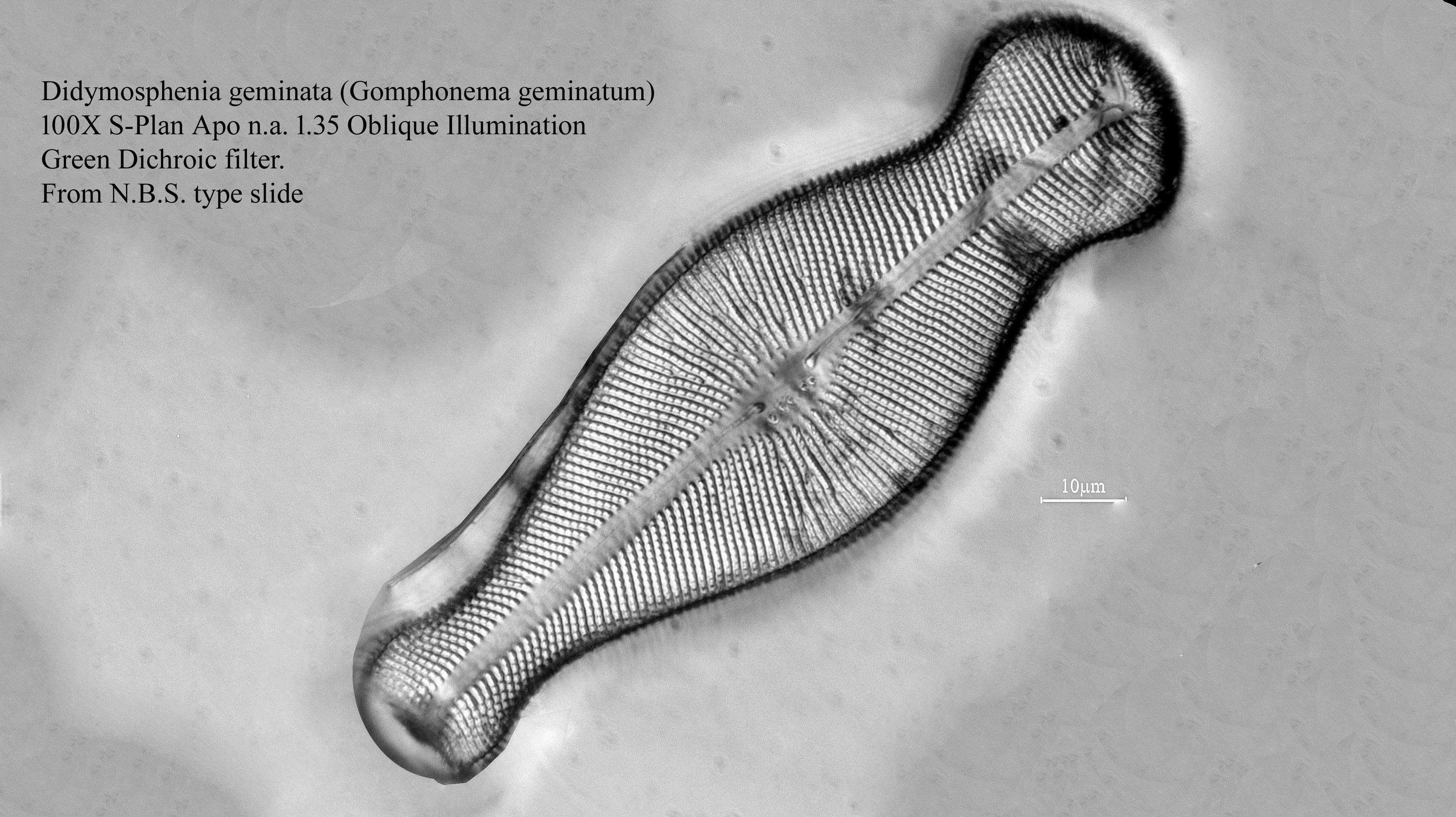 diatom