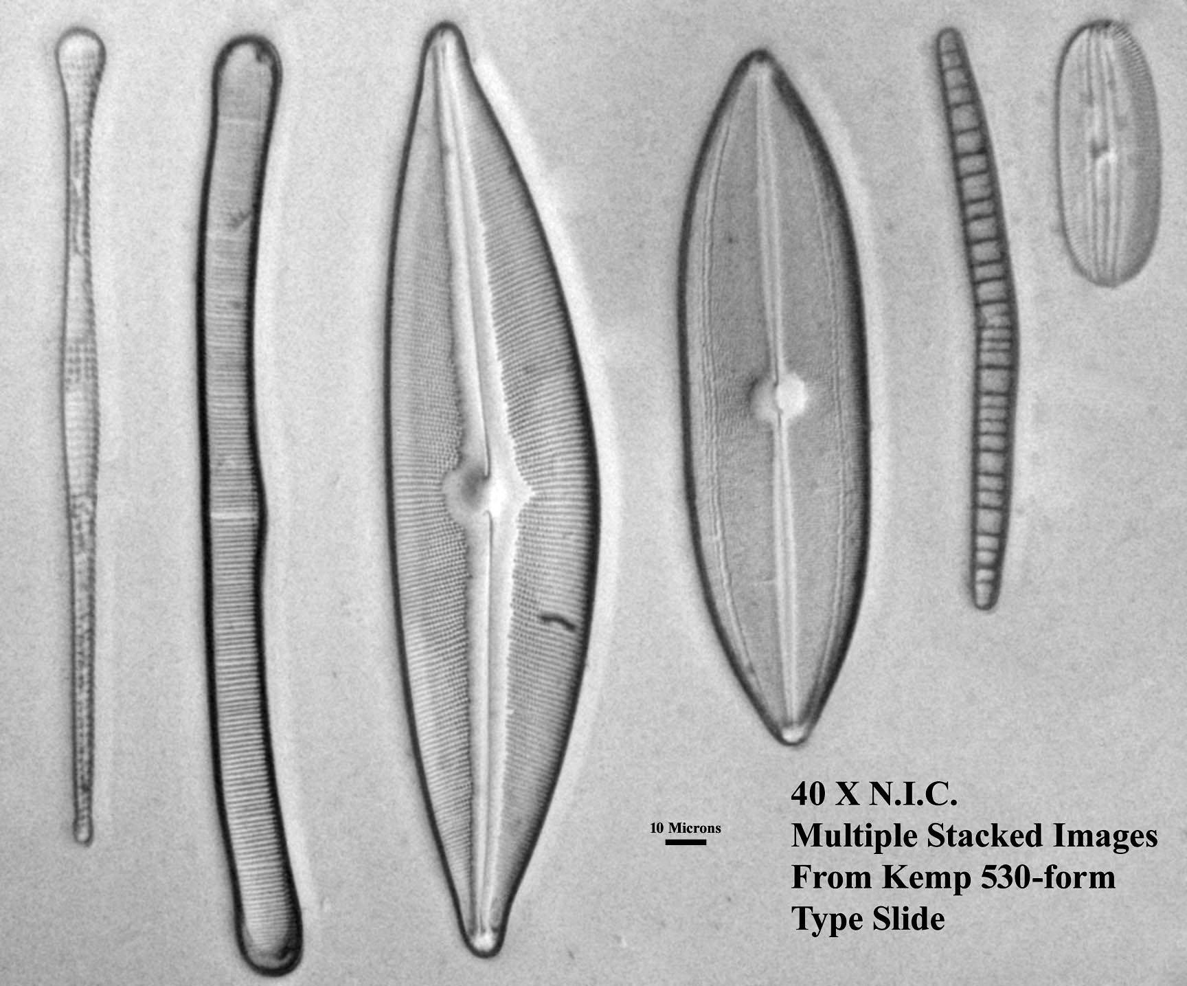 diatom