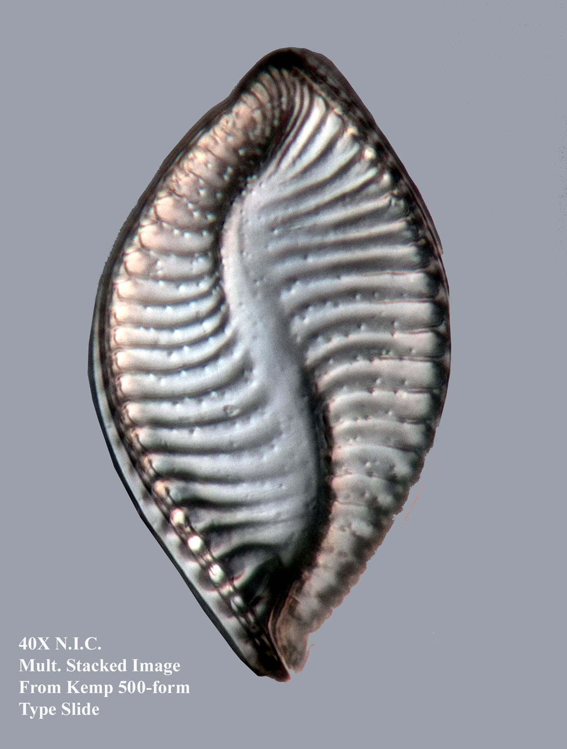 diatom