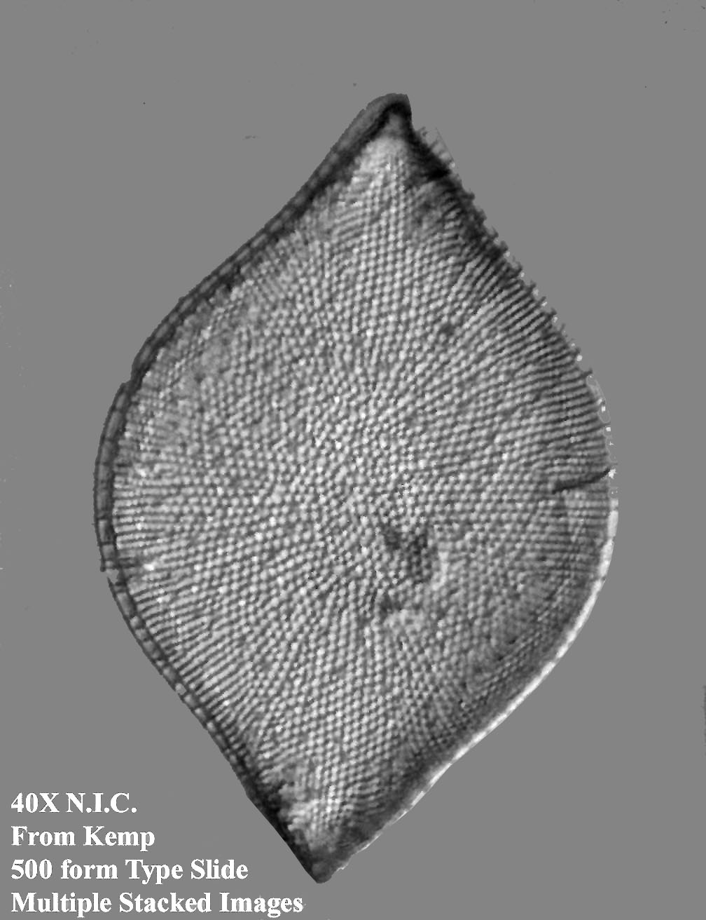 diatom