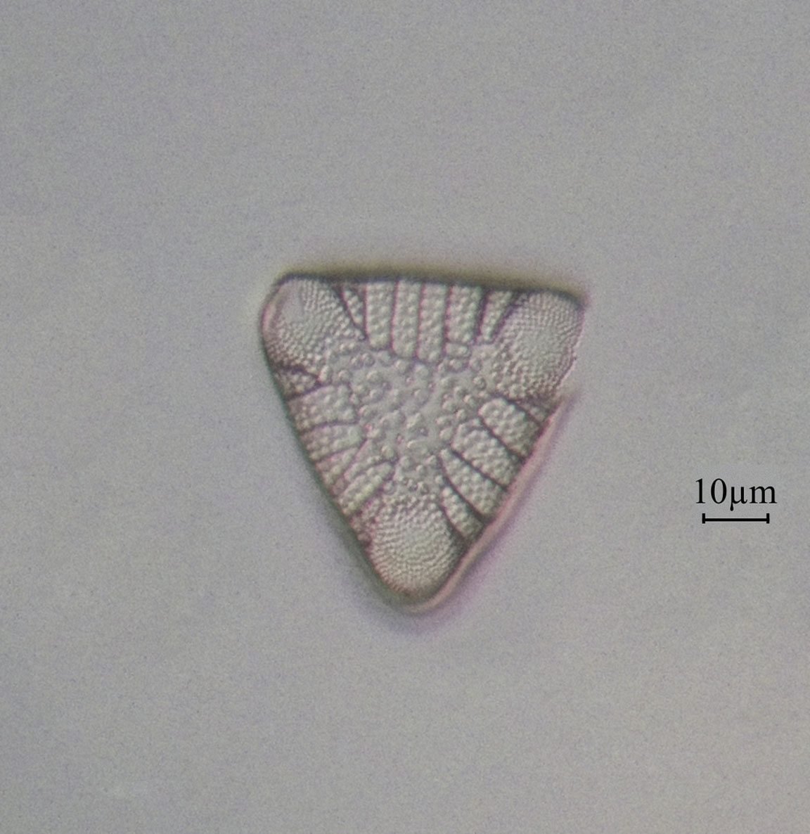 diatom