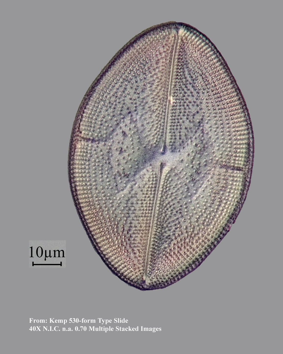 diatom