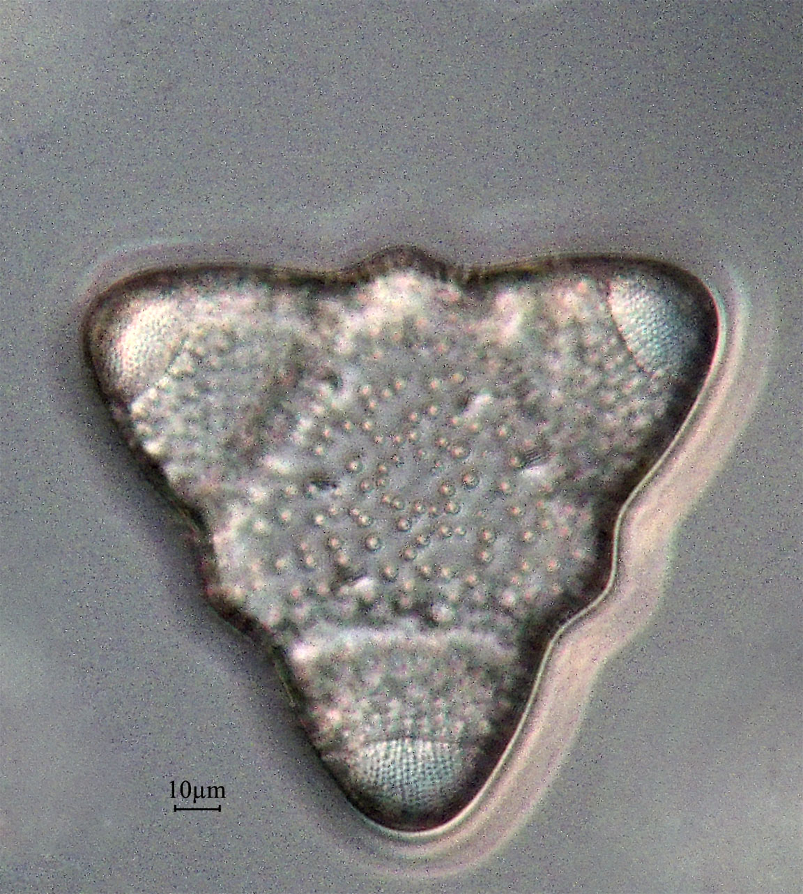 diatom