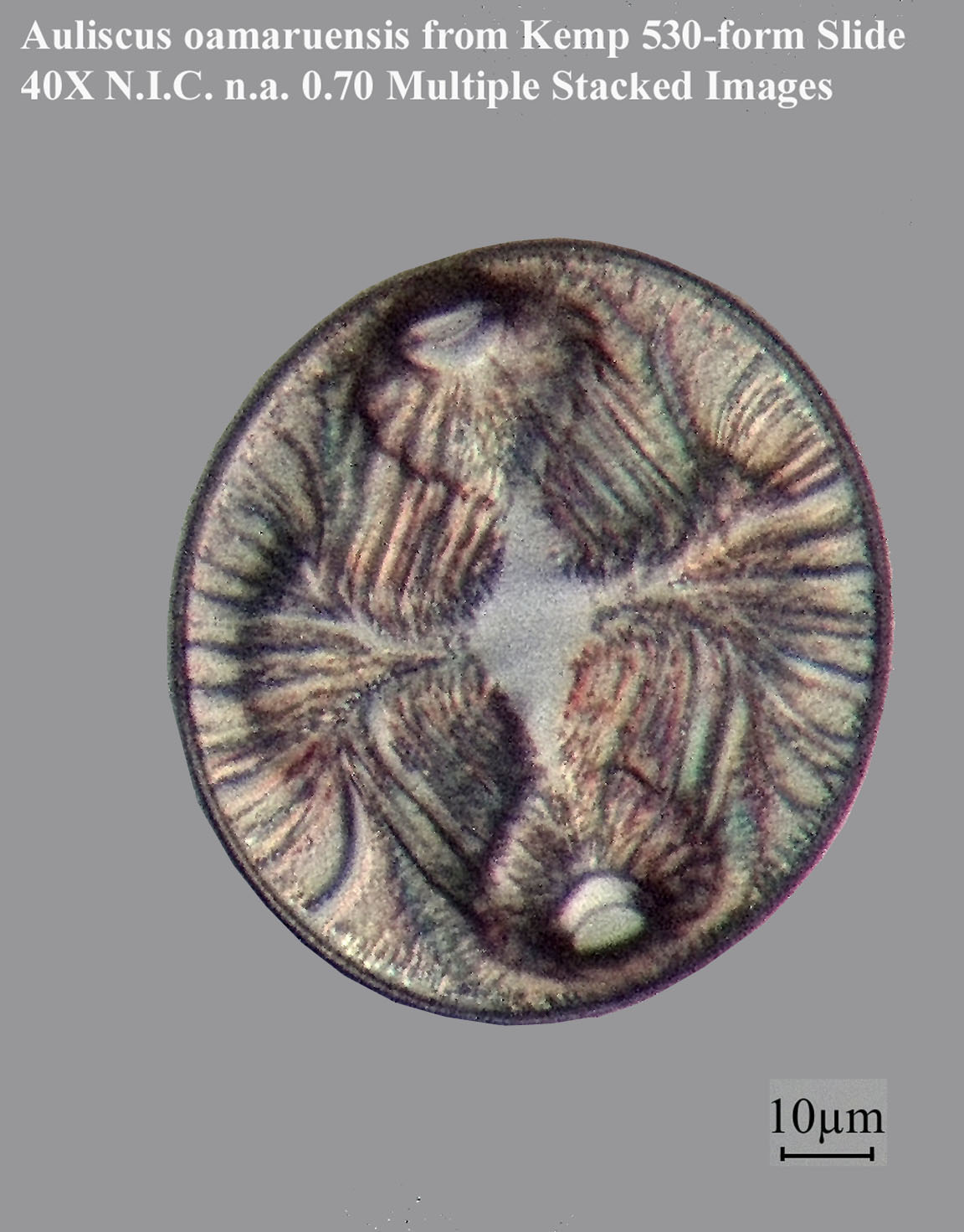 diatom