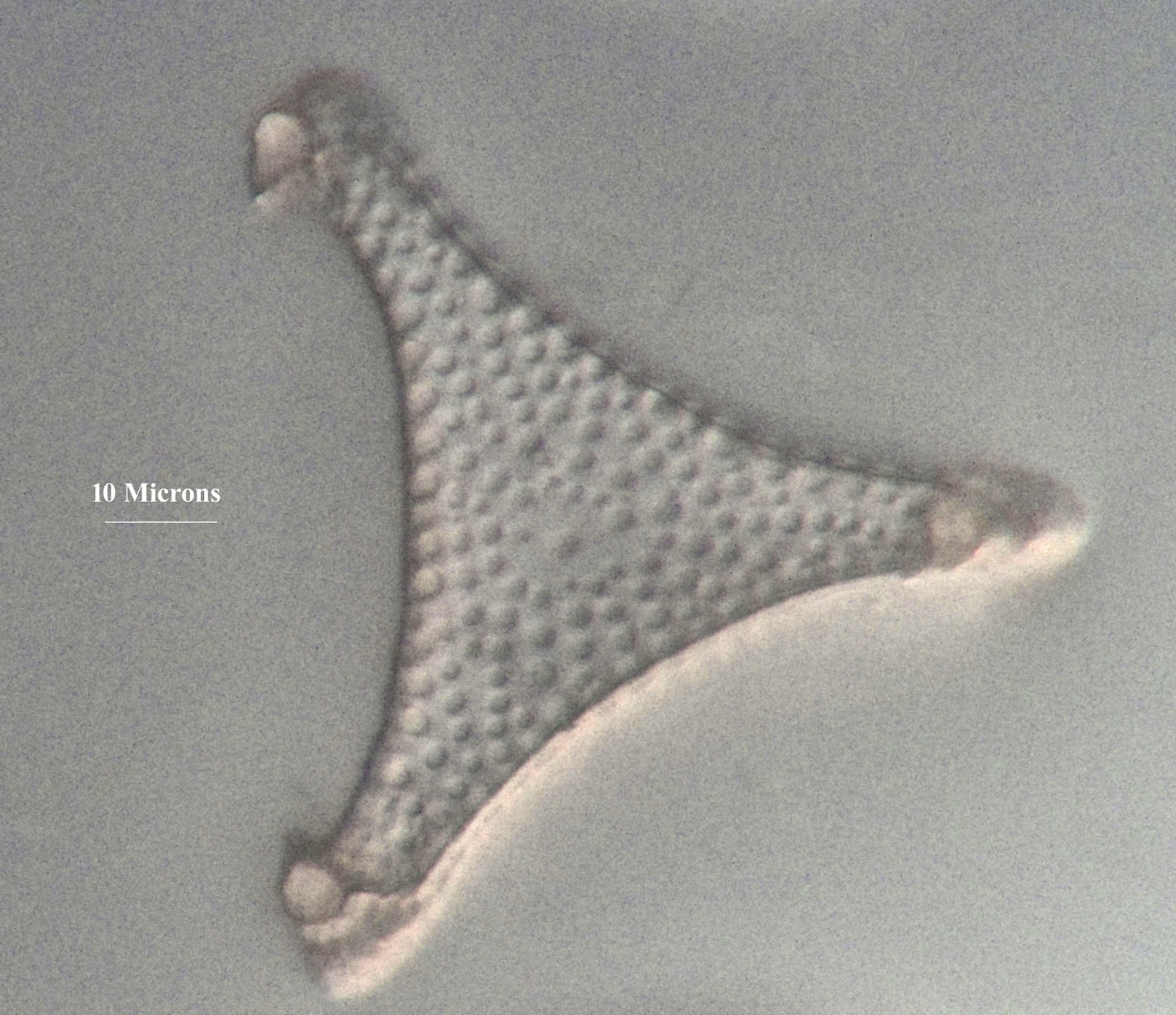 diatom