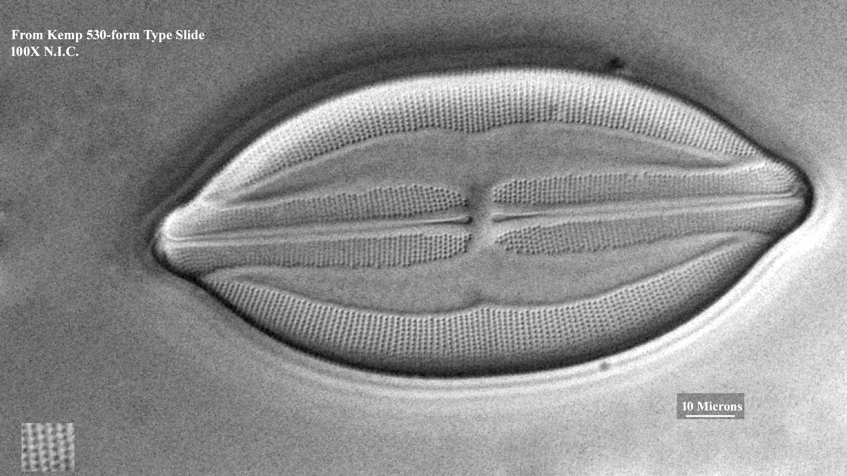 diatom
