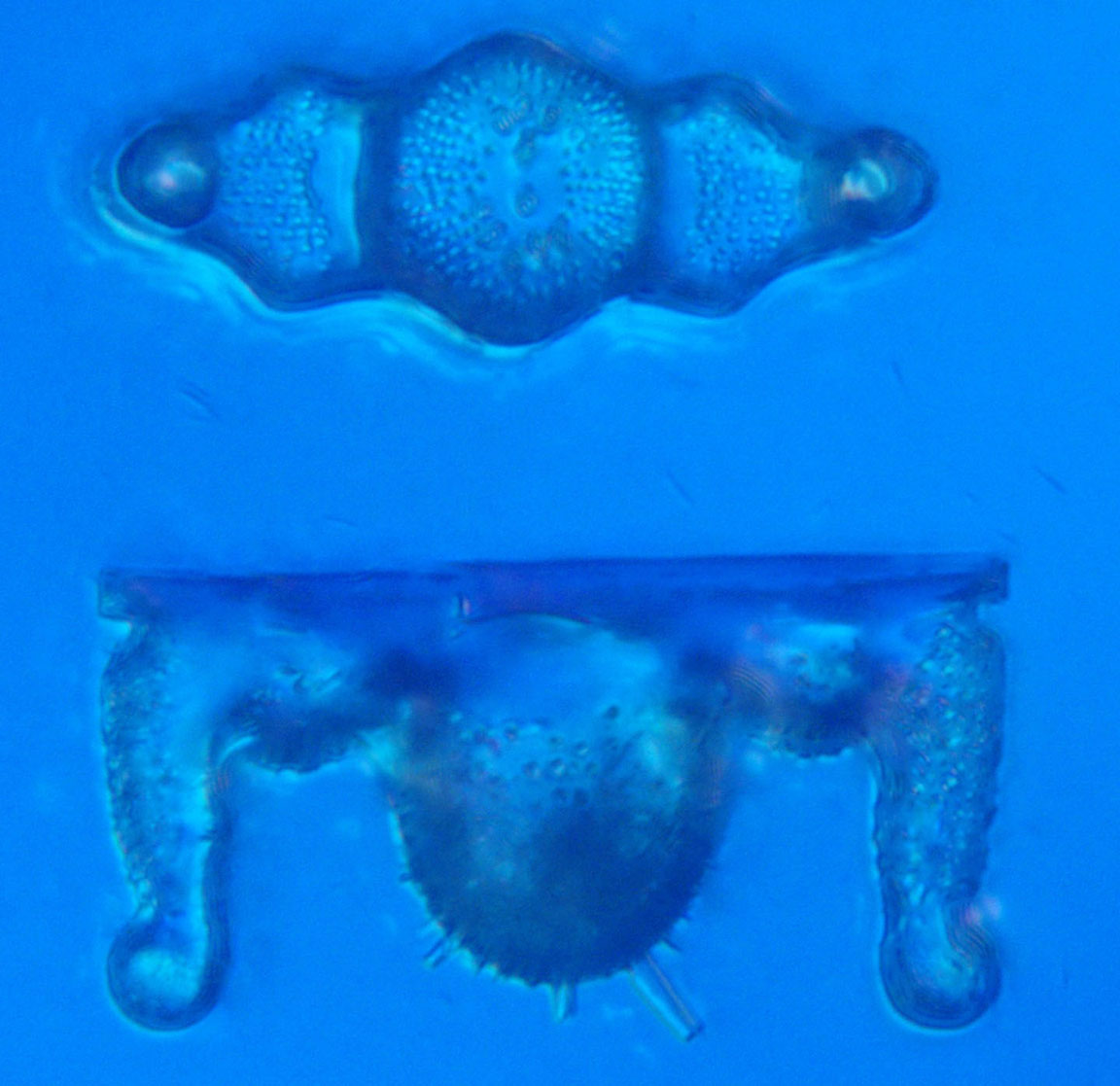 diatom
