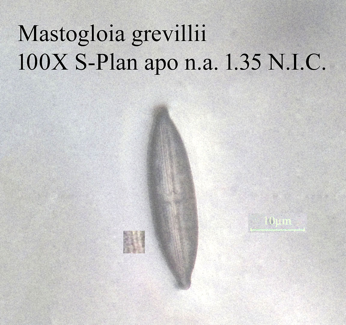 diatom