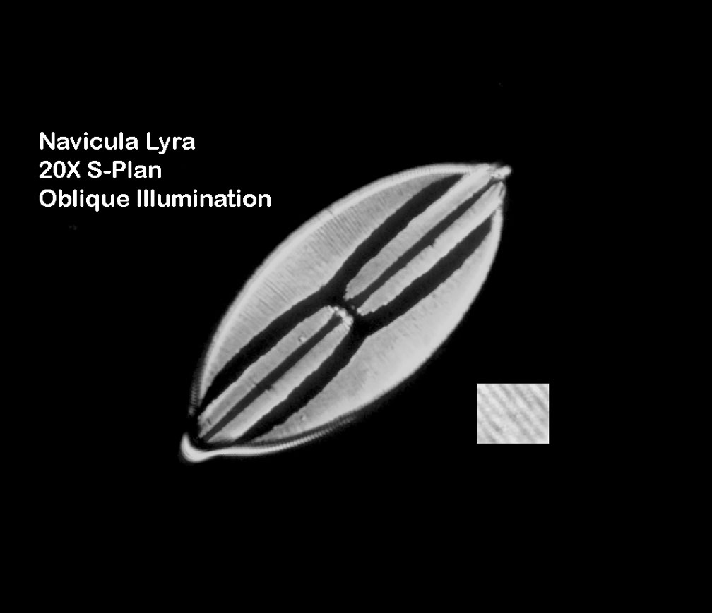 diatom