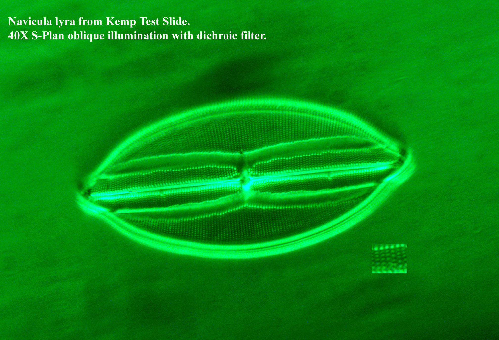 diatom