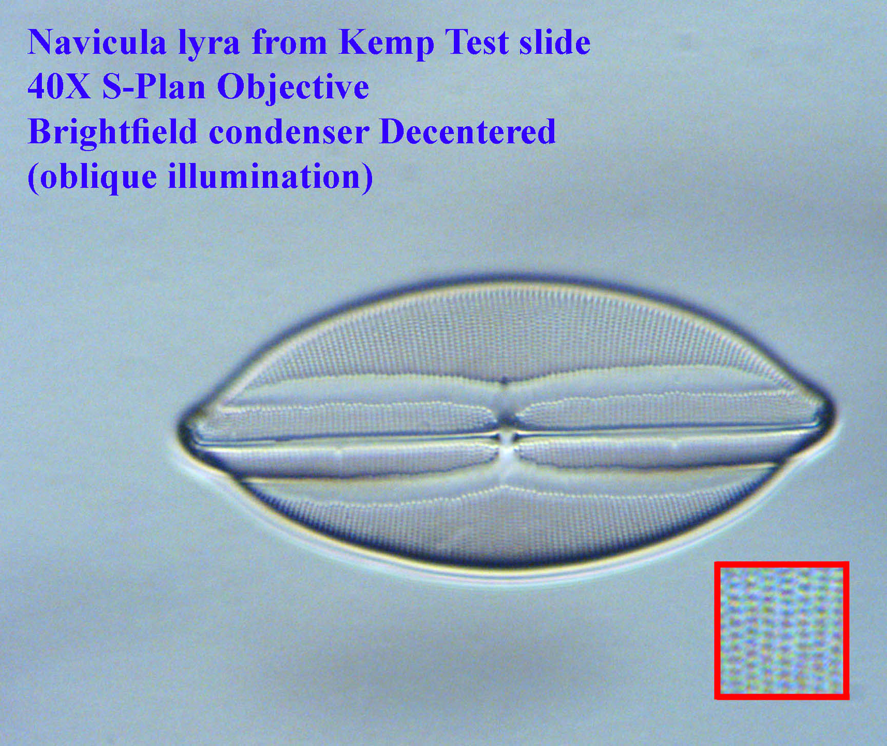 diatom