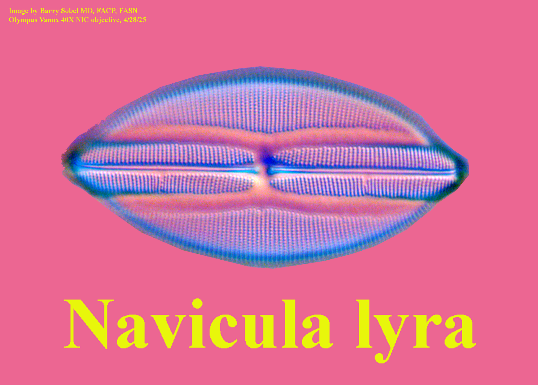 diatom