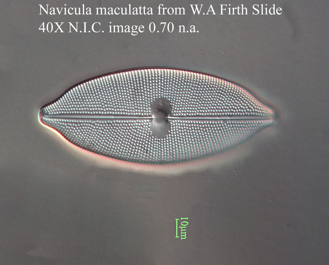 Navicula maculata diatom