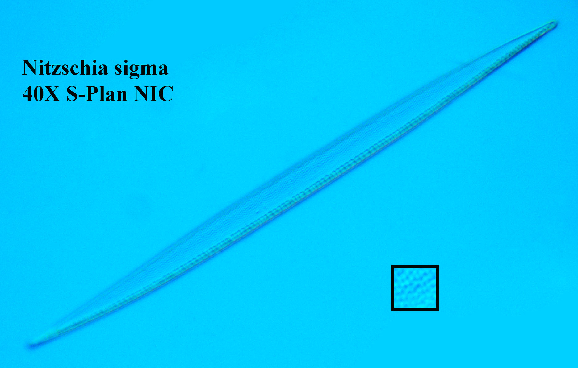 N. sigma 40X DIC illumination