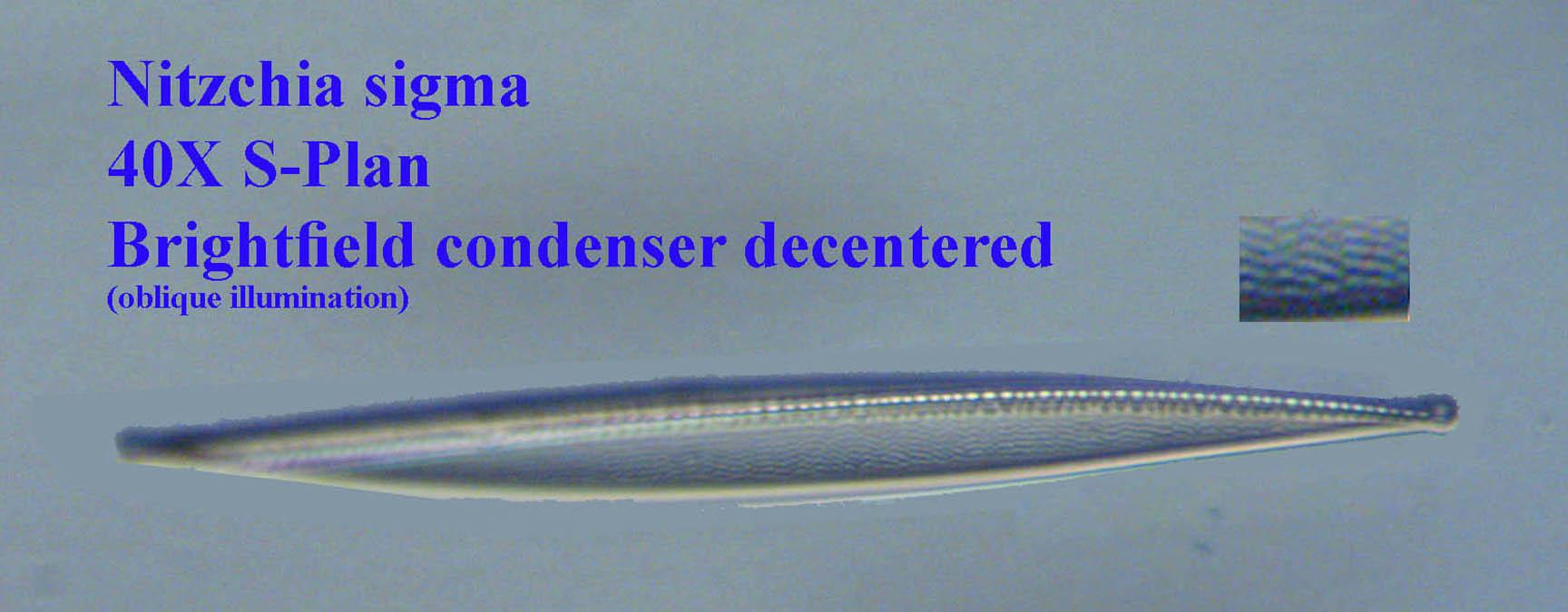 N. sigma oblique illumination