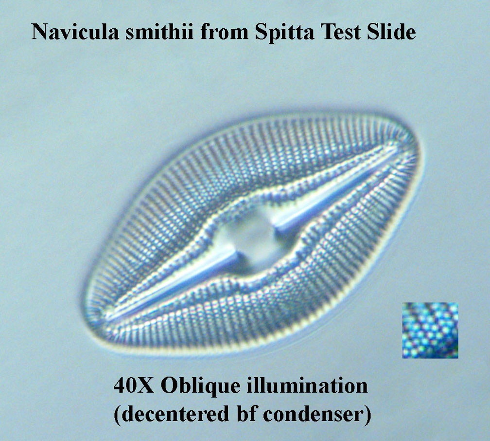 diatom