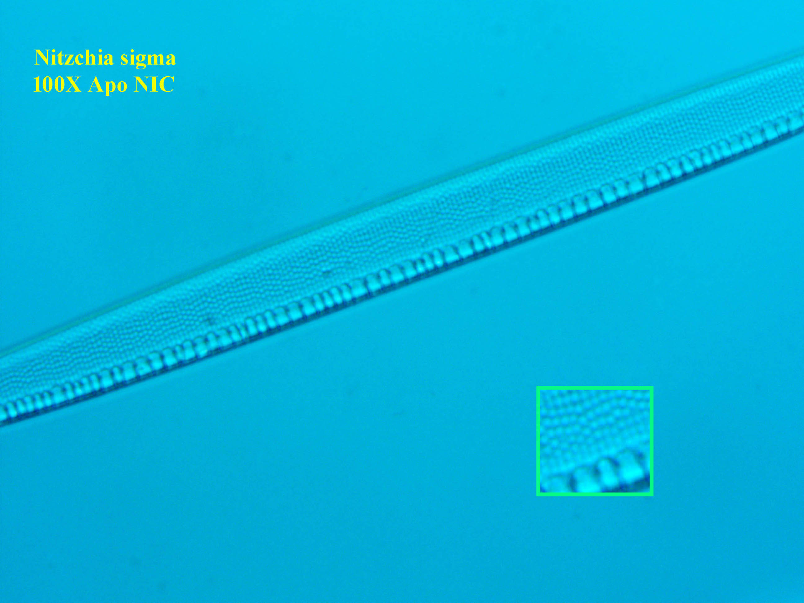 diatom
