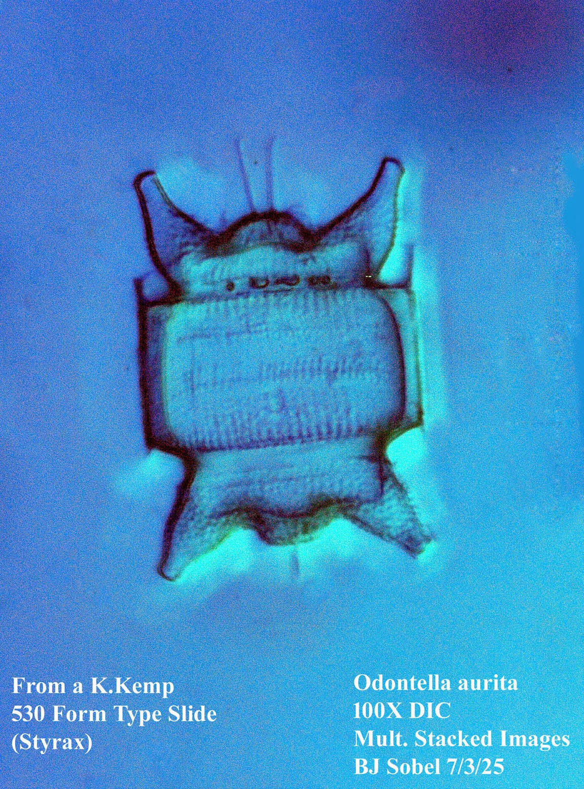 diatom