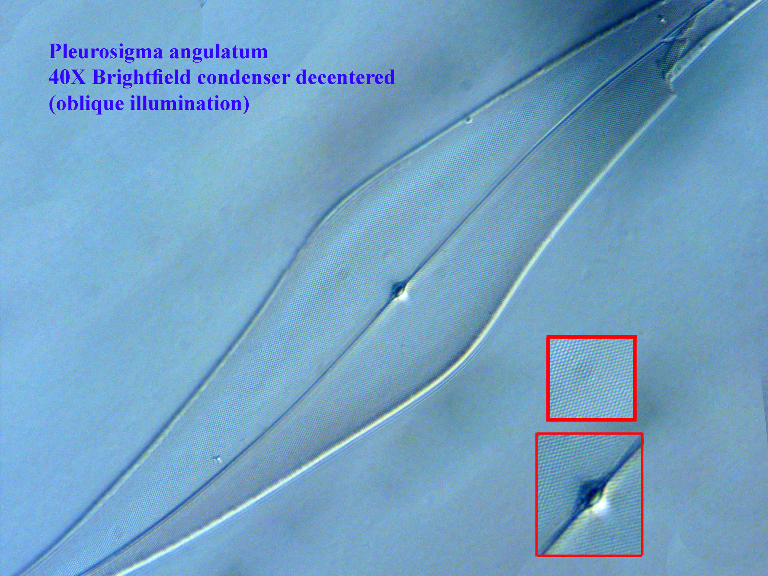 diatom