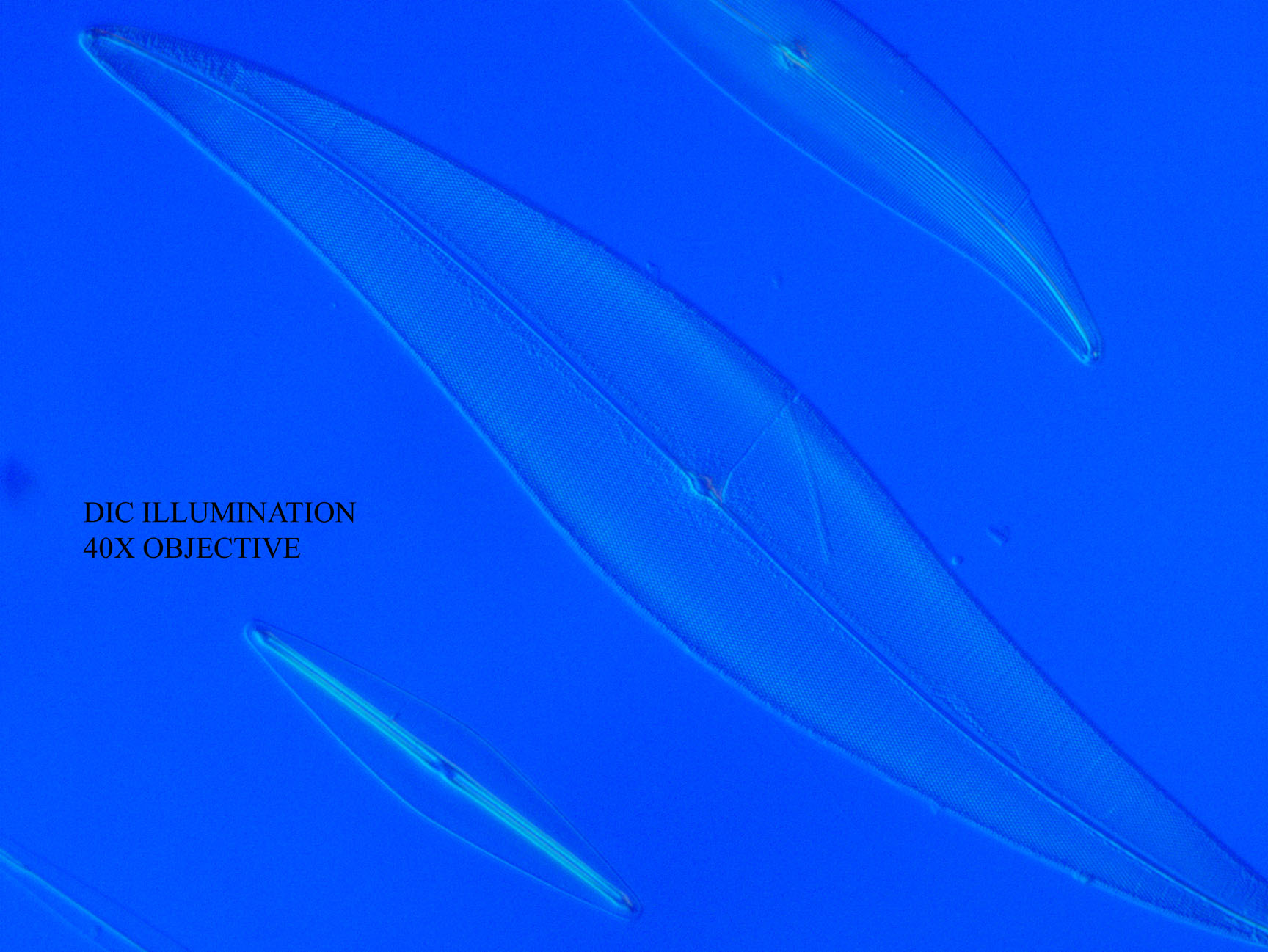 Pleurosigma DIC