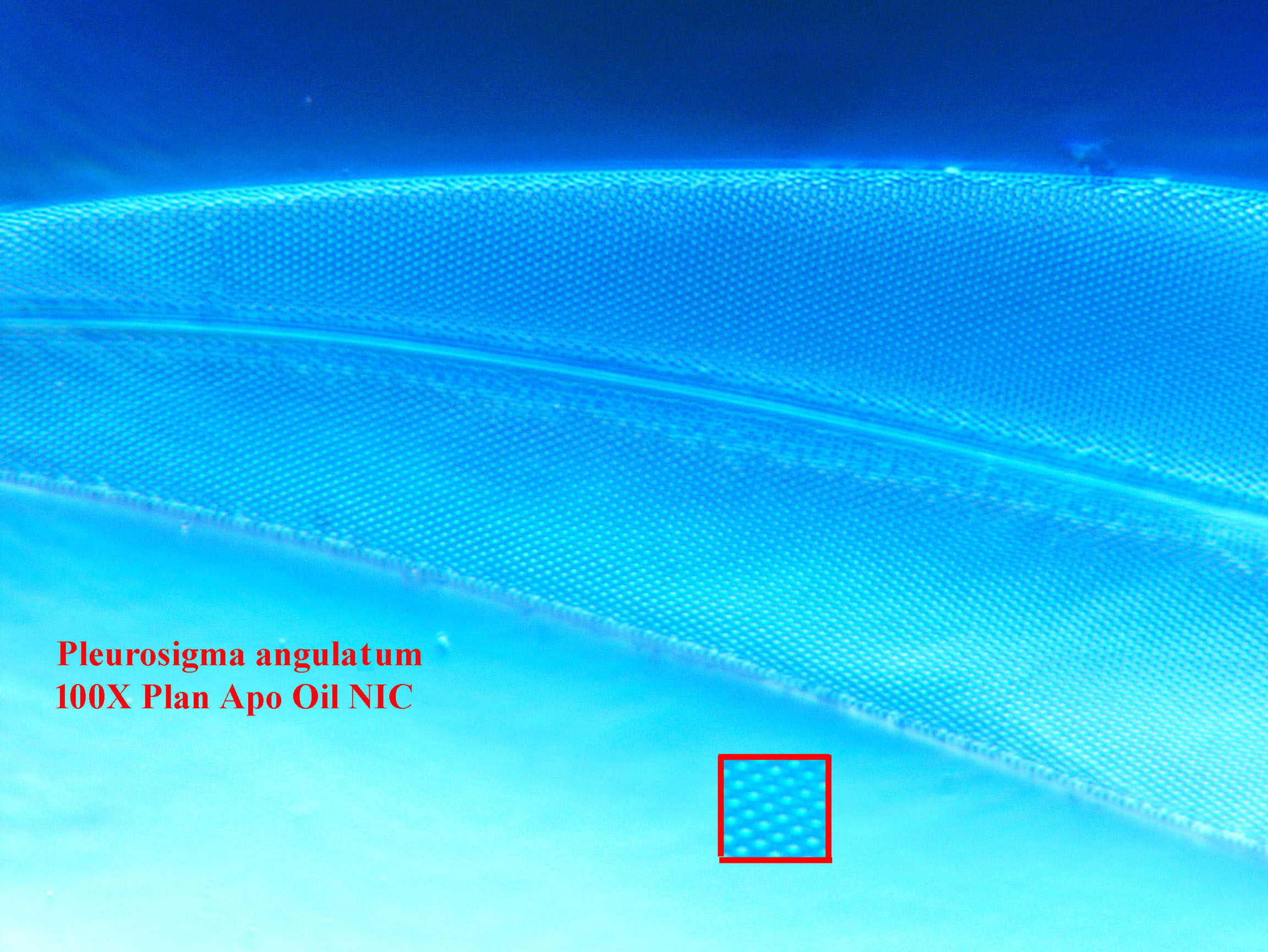 diatom