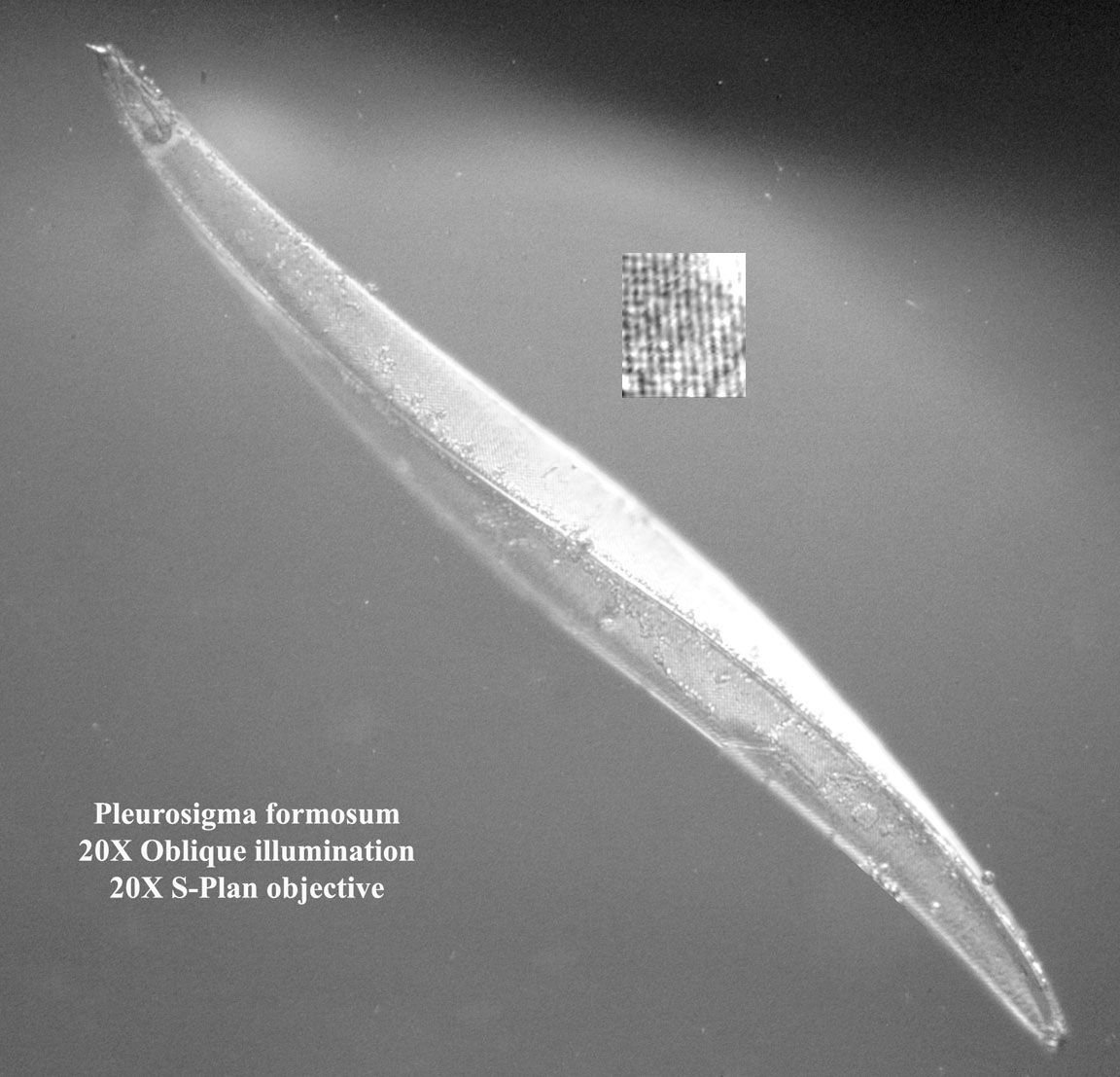 diatom