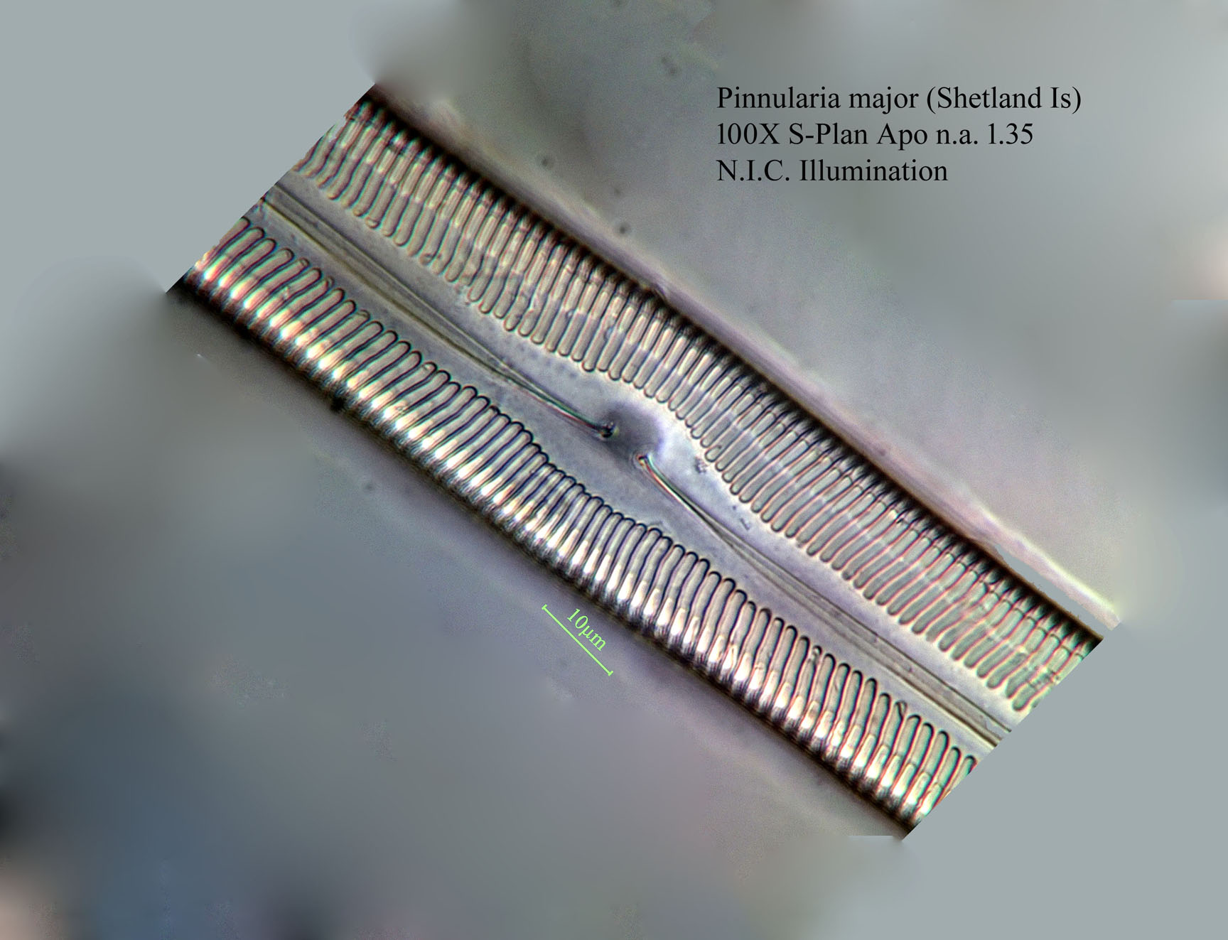 diatom