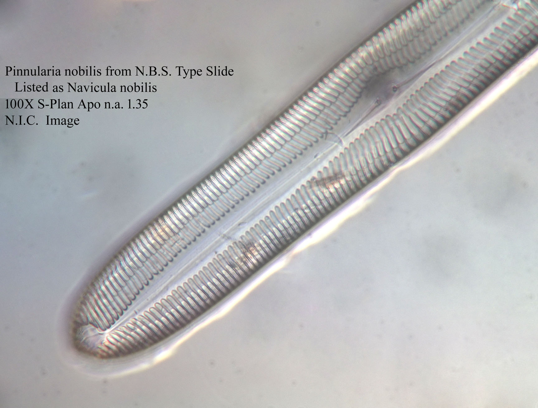 diatom