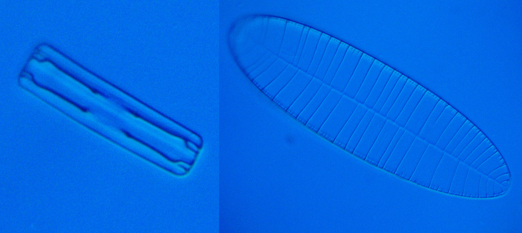 diatom