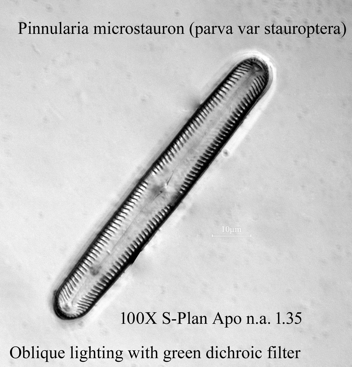 diatom