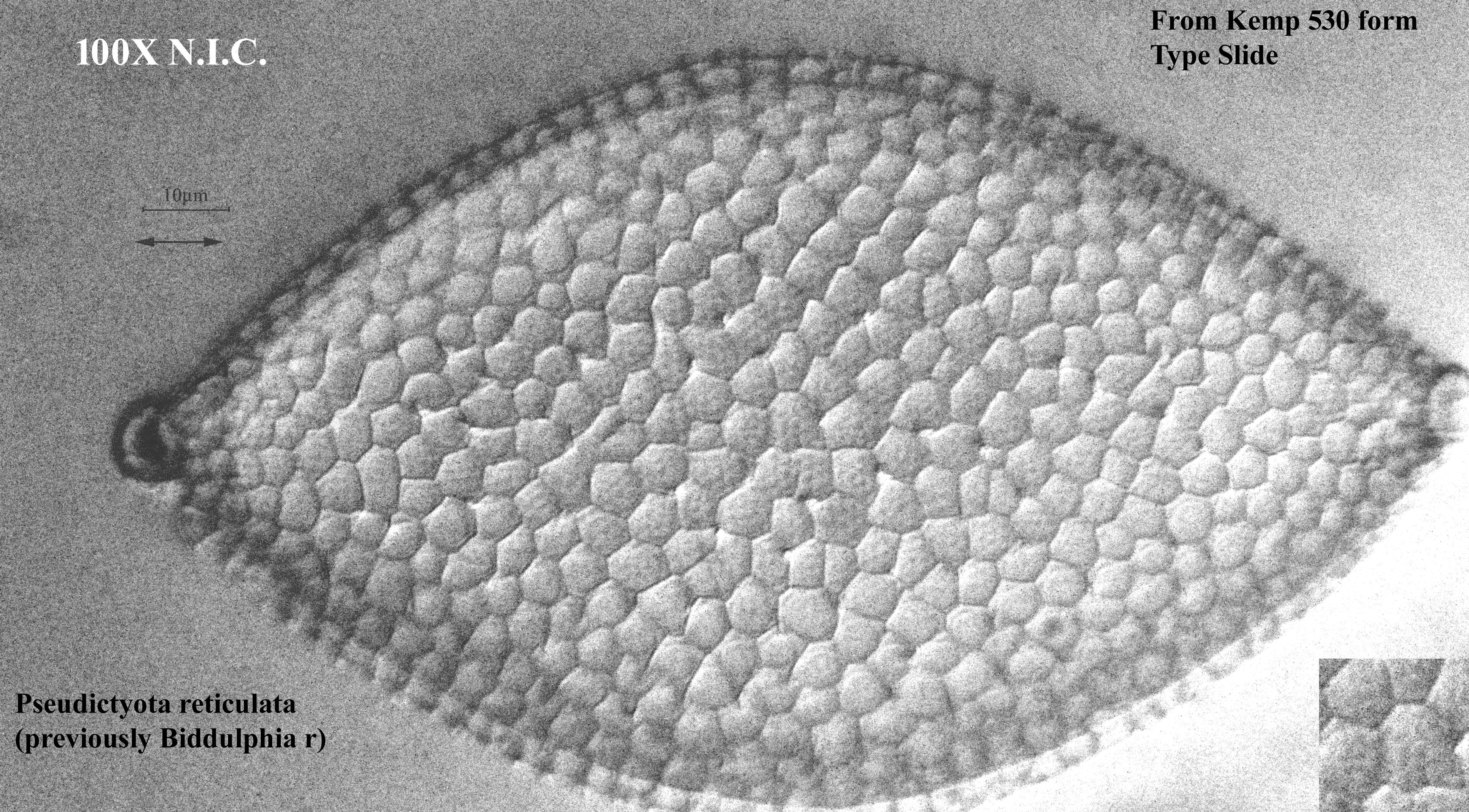 diatom