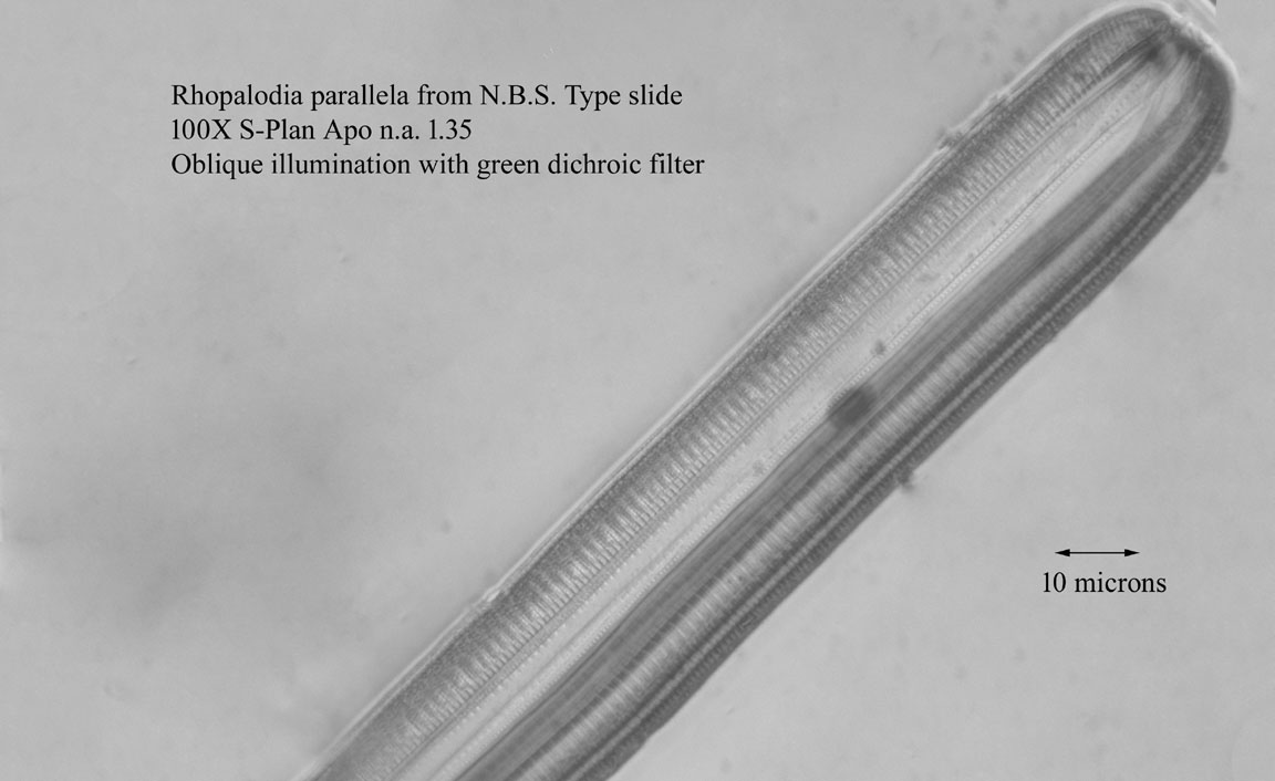 diatom