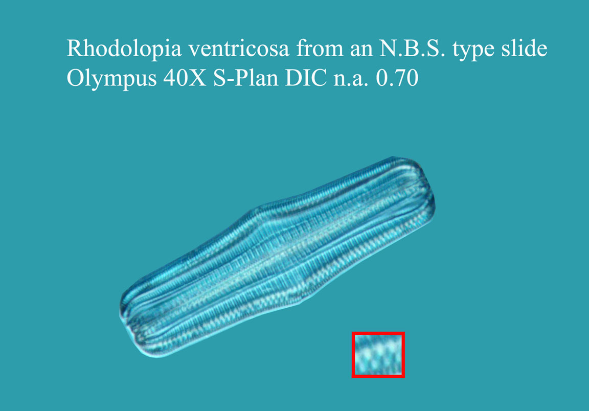 diatom