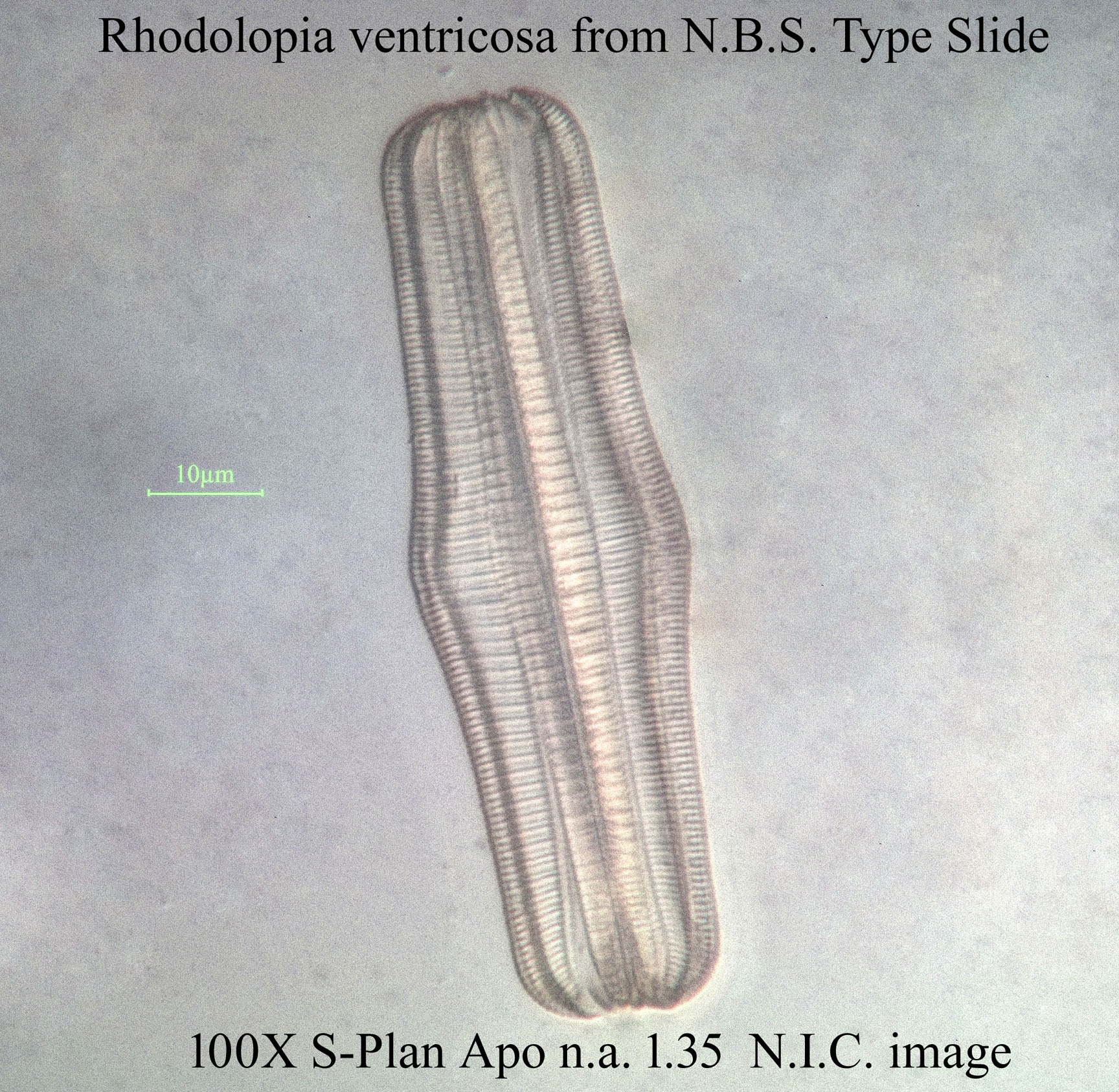 diatom