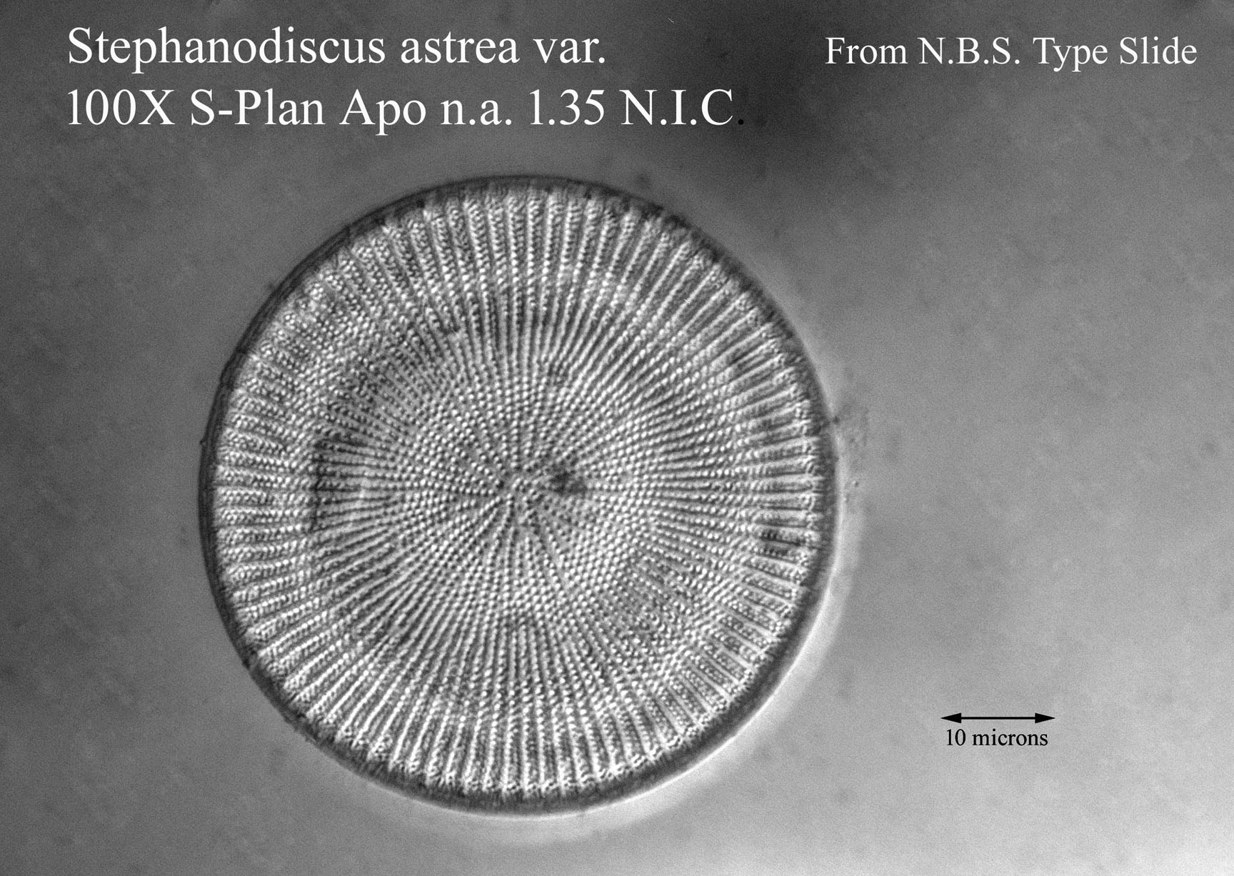 diatom