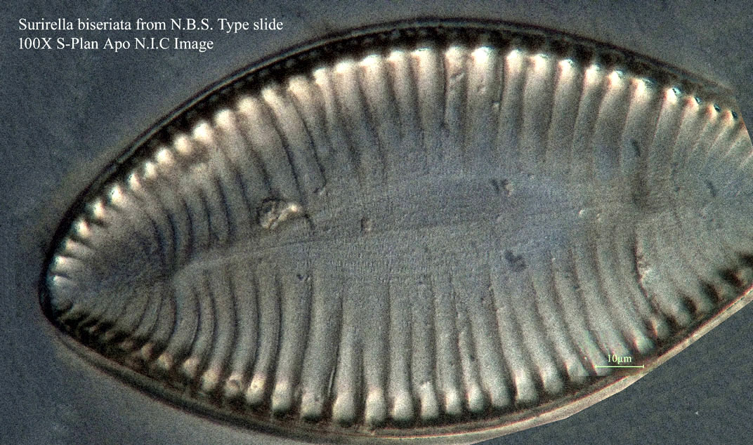 diatom