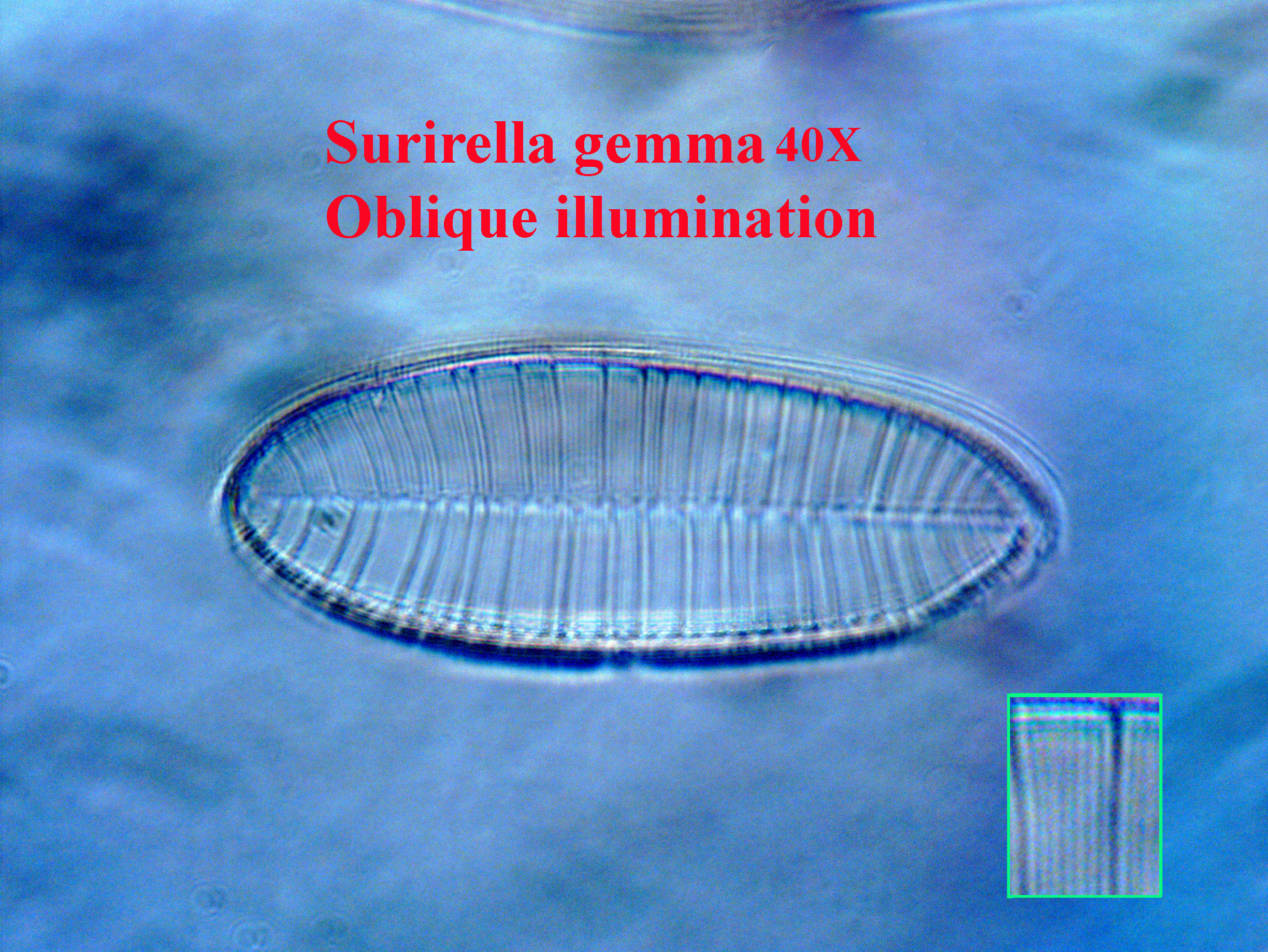 diatom
