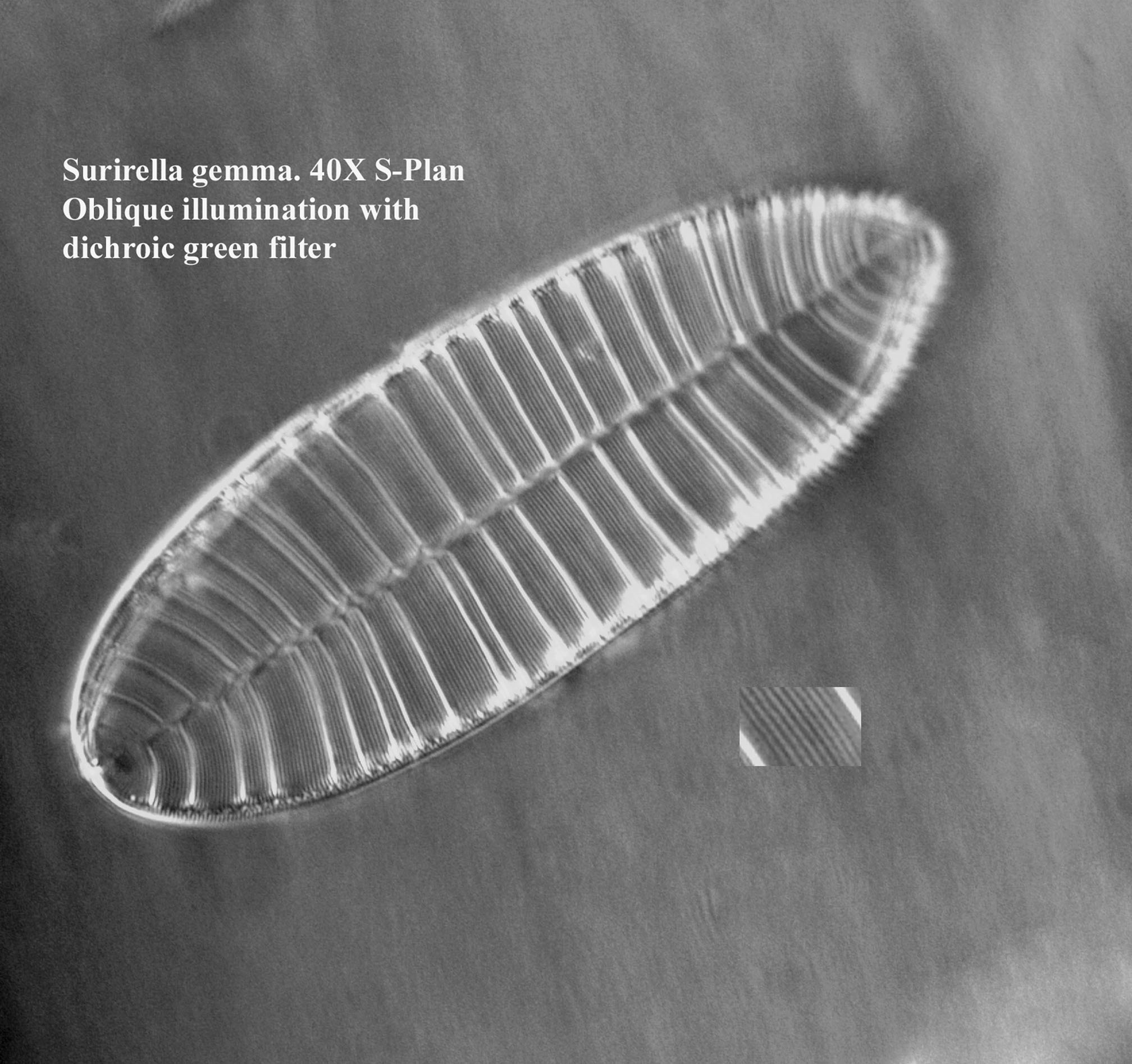 diatom