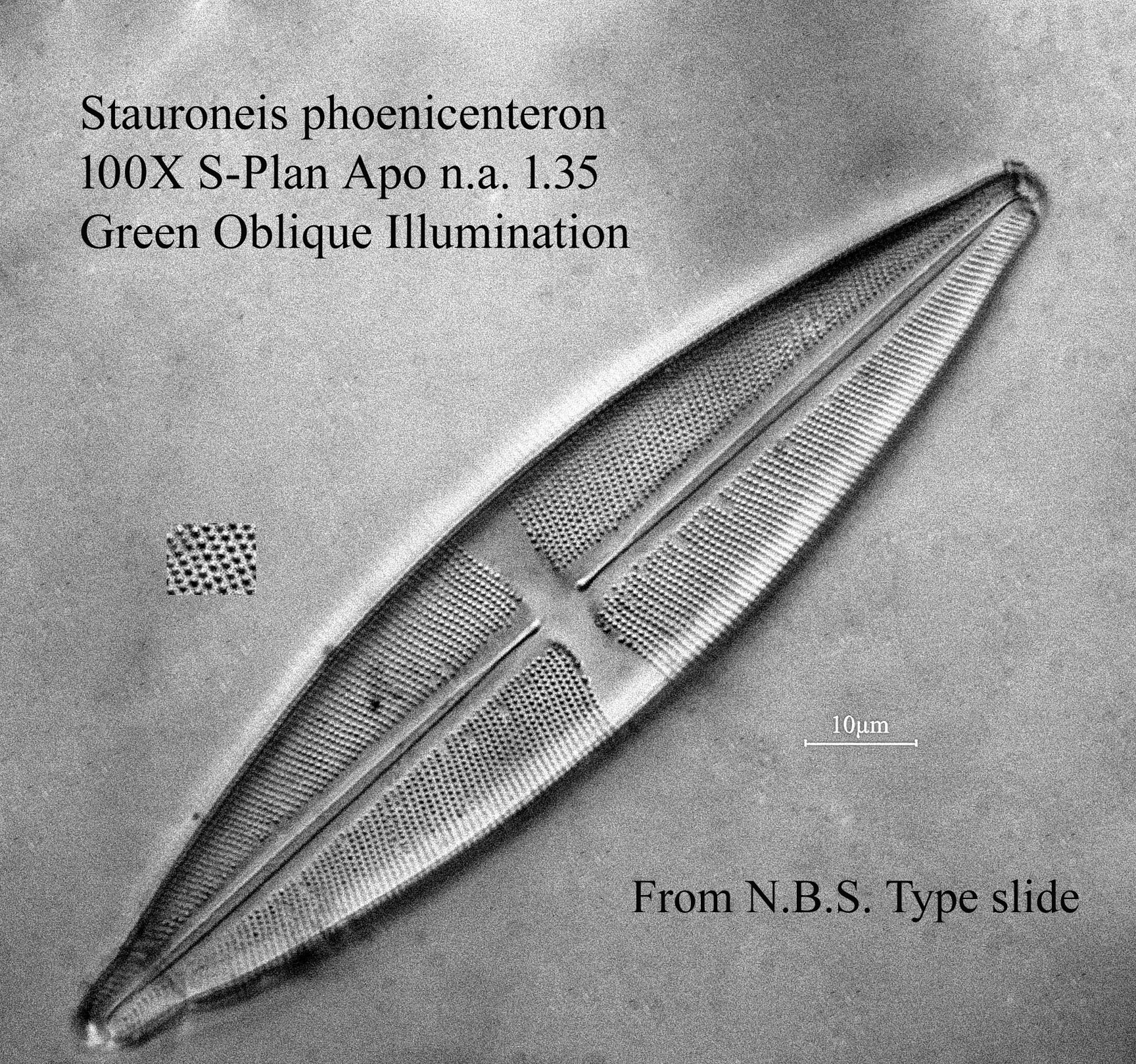 diatom