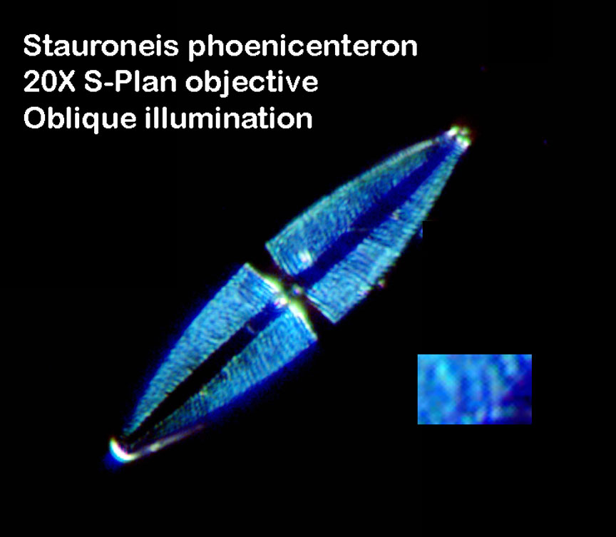 diatom