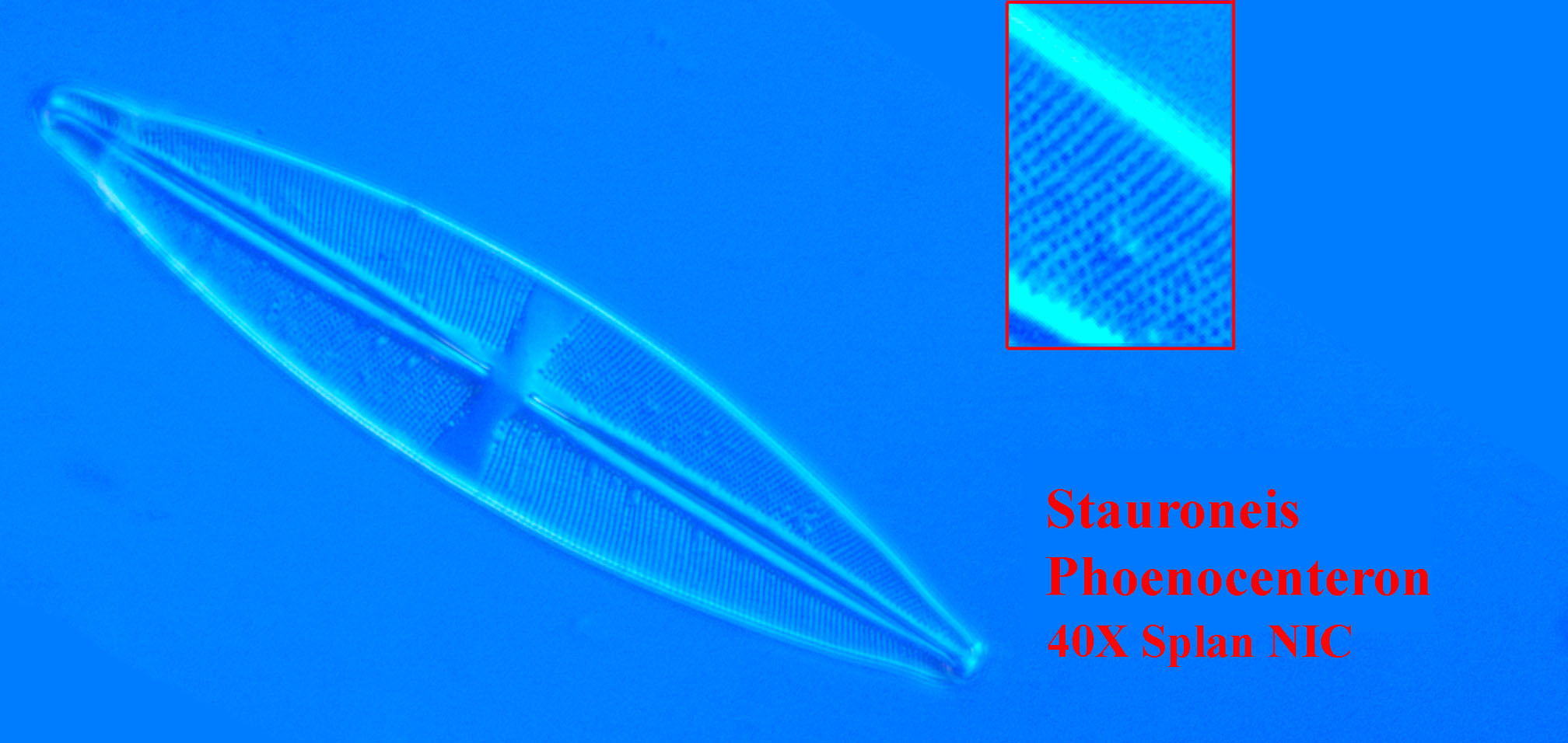 diatom